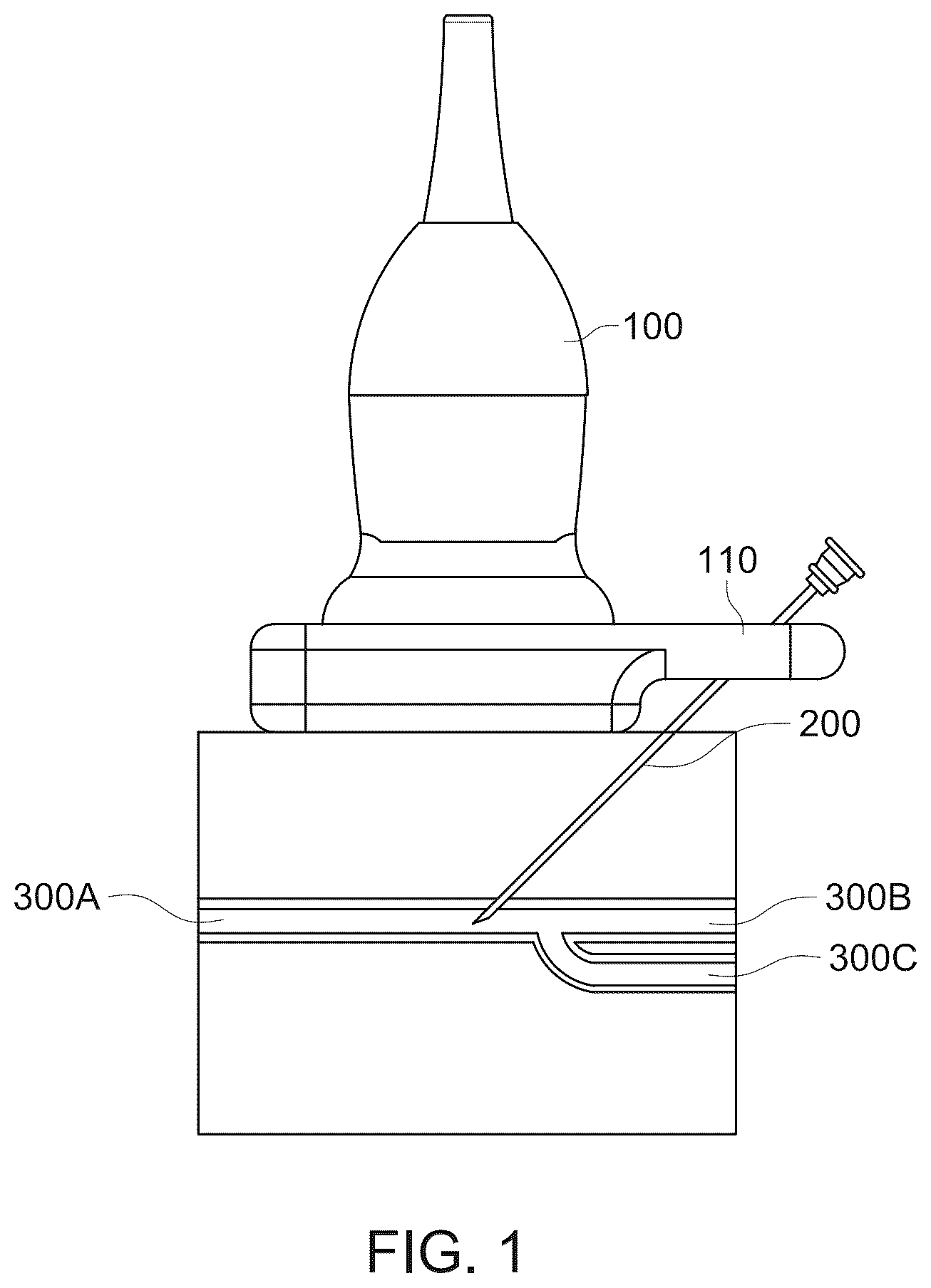 Patent US12564420 — Needle guidance system — Figure 1