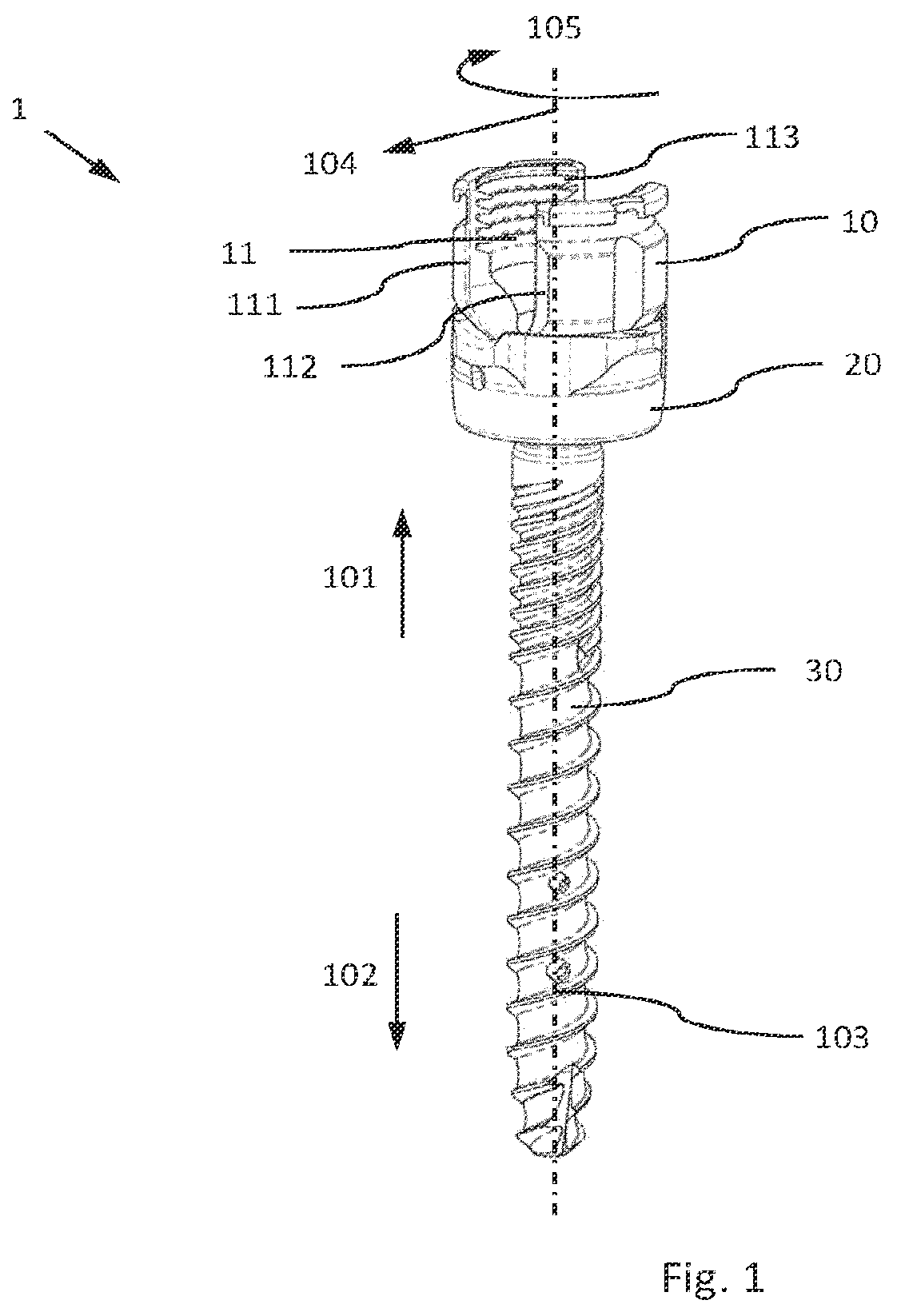 Patent US12564426 — Modular and temporarily fixable osteosynthesis device for vertebrae — Figure 1