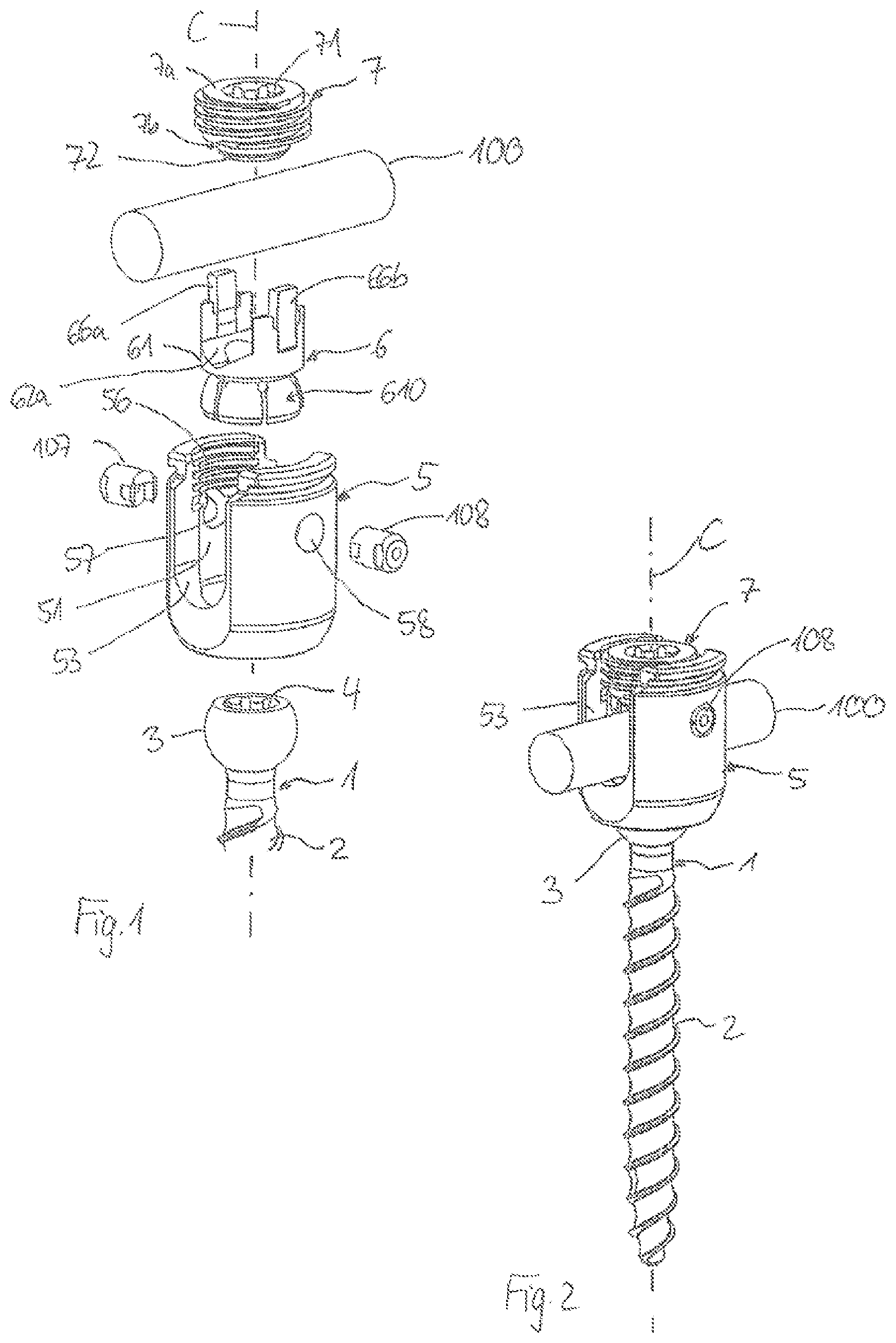 Patent US12564427 — Polyaxial bone anchoring device — Figure 1