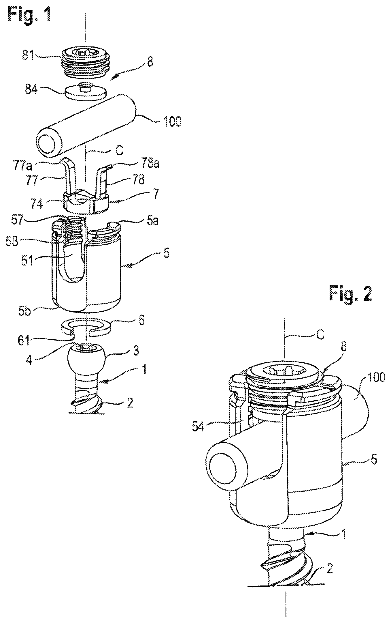 Patent US12564431 — Polyaxial bone anchoring device — Figure 1