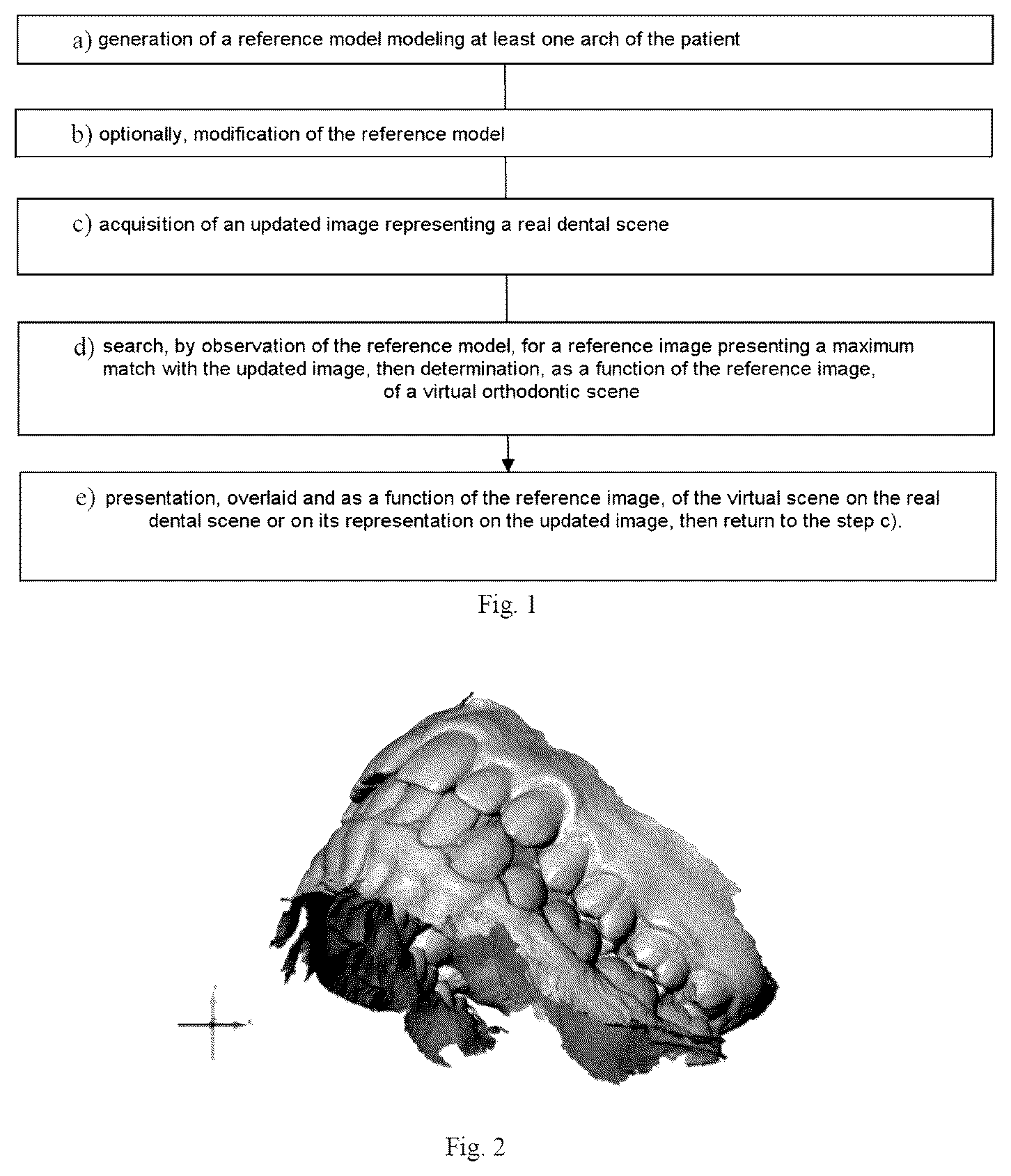 Patent US12564478 — Method for analysing a dental situation — Figure 1