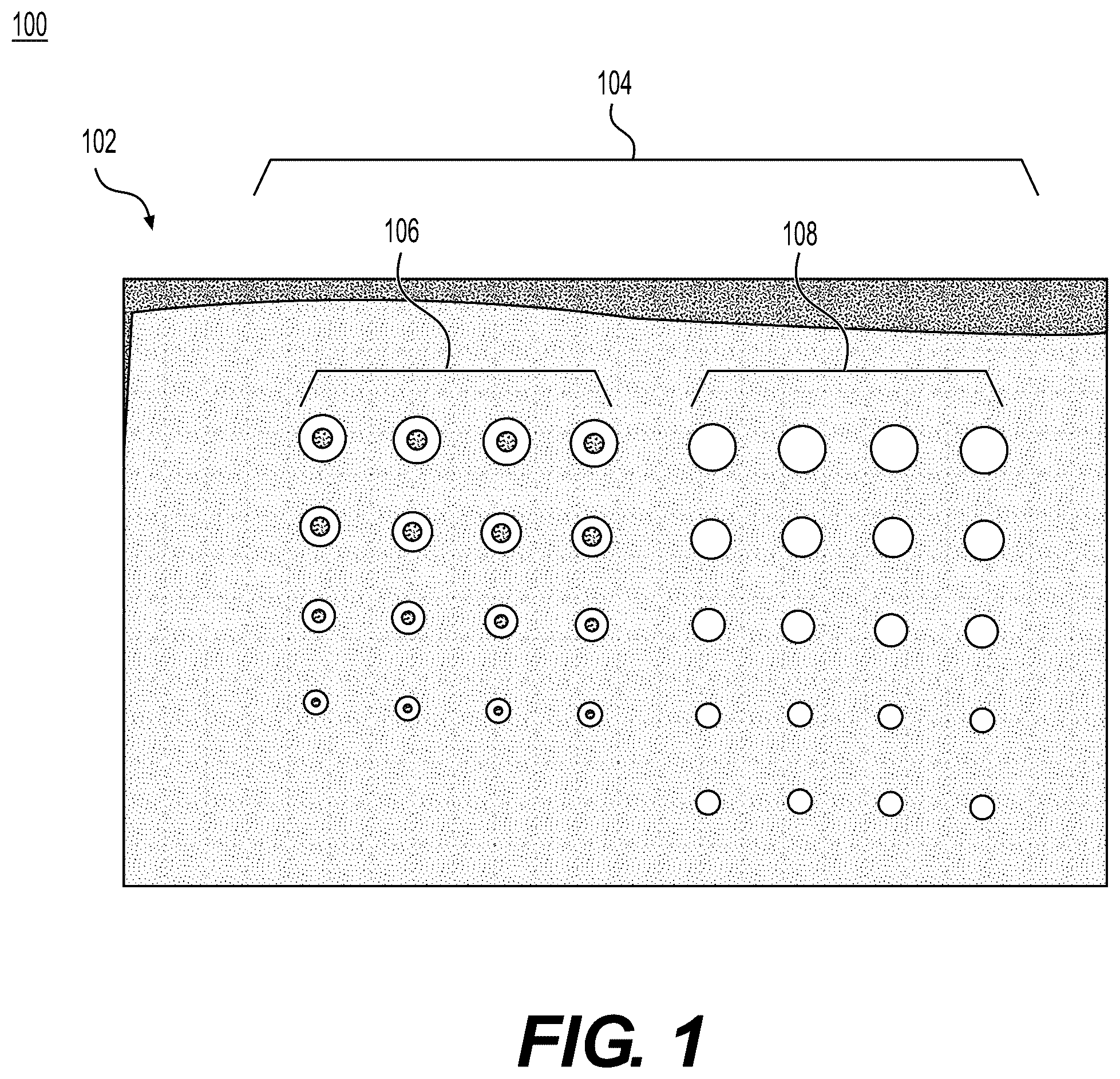 Patent US12564485 — Tissue grafts with pre-made attachment points — Figure 1
