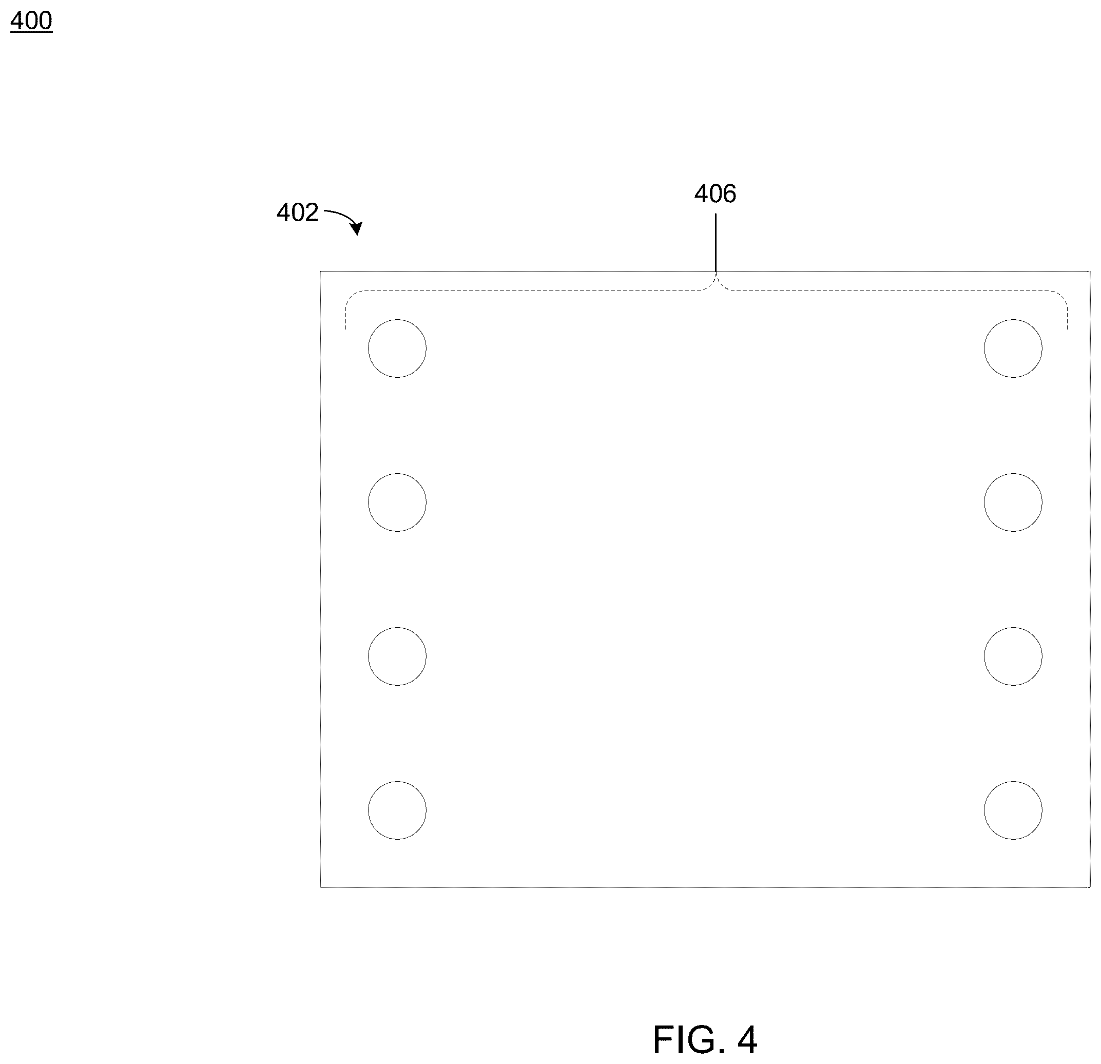 Patent US12564485 Figure 4 – Tissue grafts with pre-made attachment points