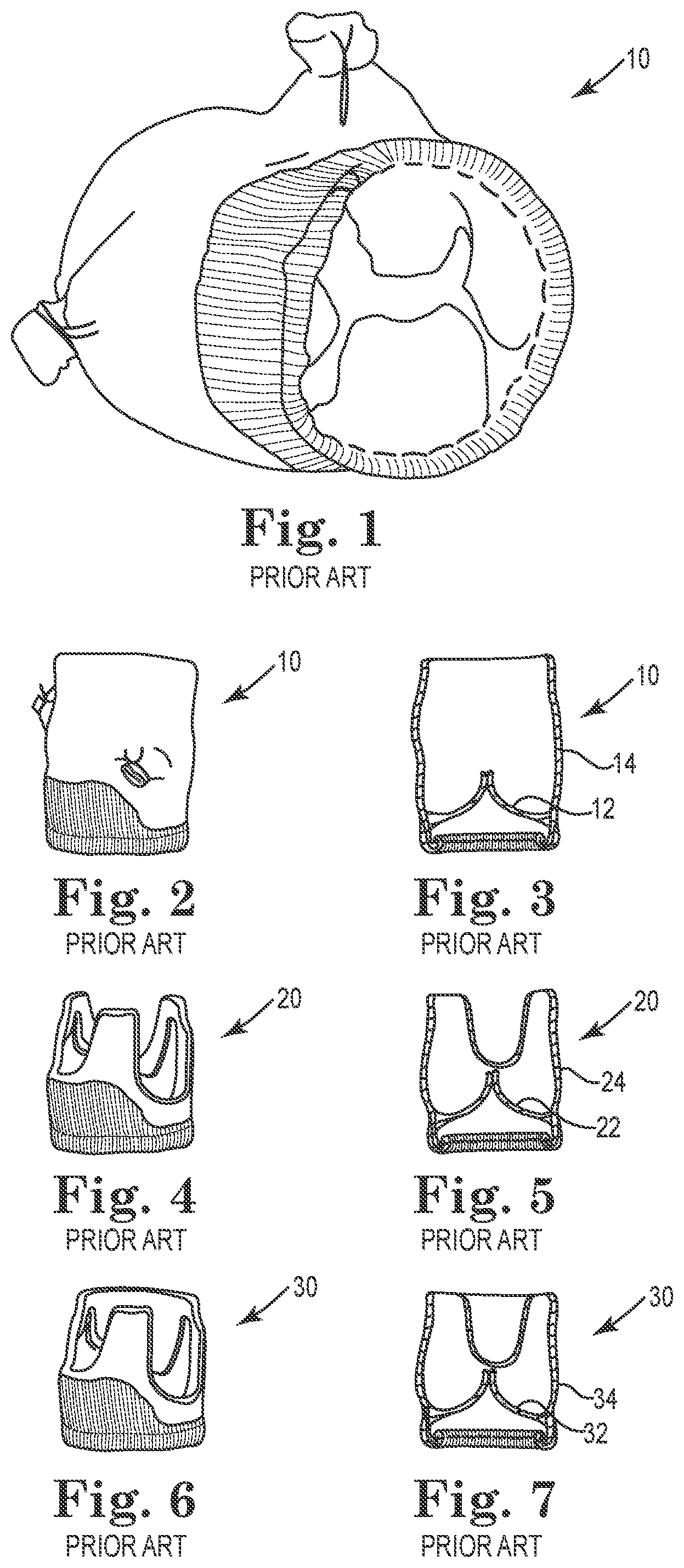 Patent US12564489 — Stented prosthetic heart valves — Figure 1