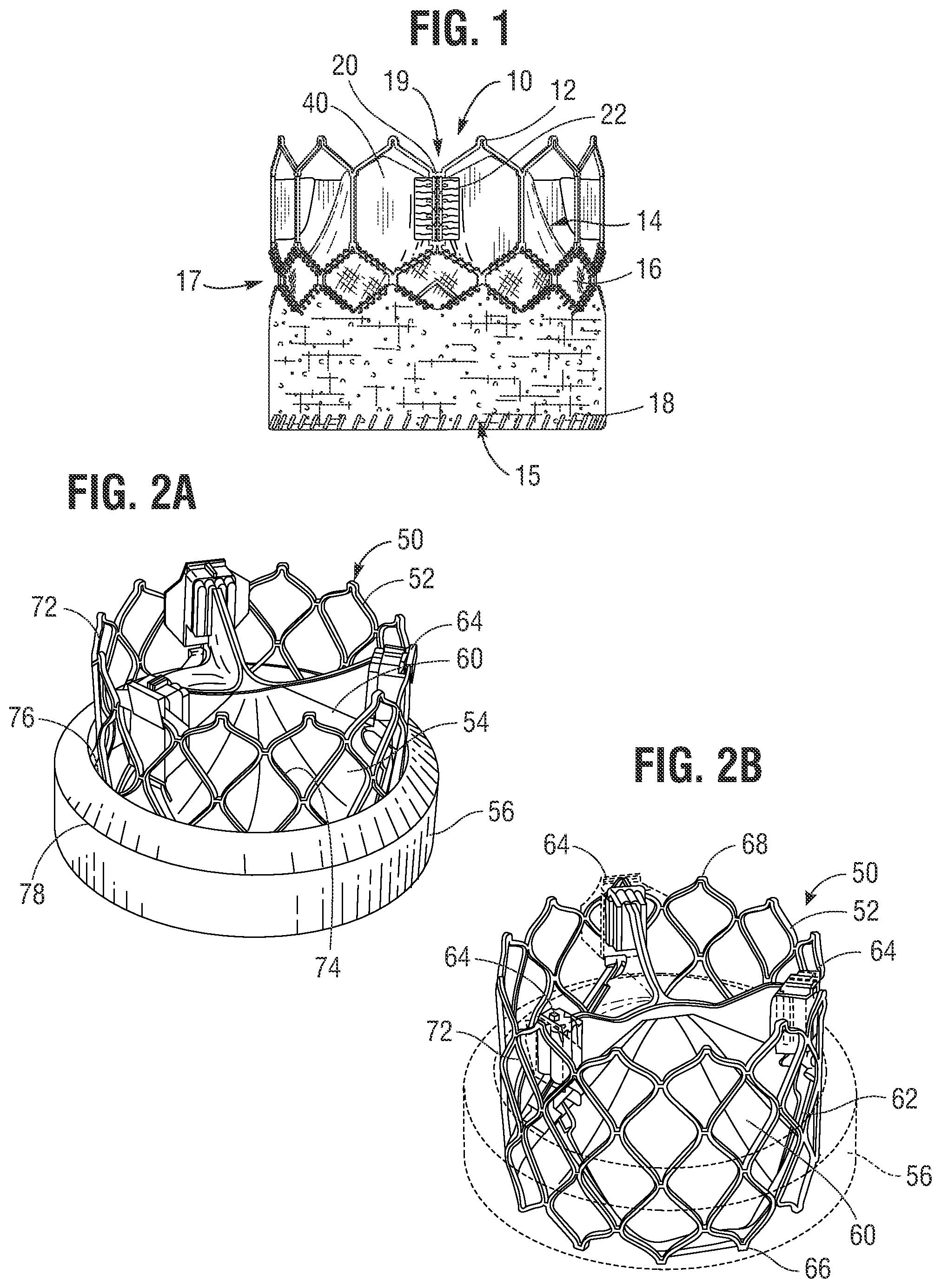 Patent US12564491 — Multi-layer covering for a prosthetic heart valve — Figure 1
