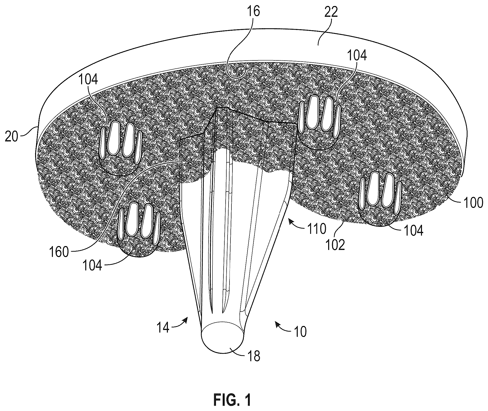 Patent US12564496 — Hybrid fixation features for three-dimensional porous structures for bone ingrowth and methods for producing — Figure 1