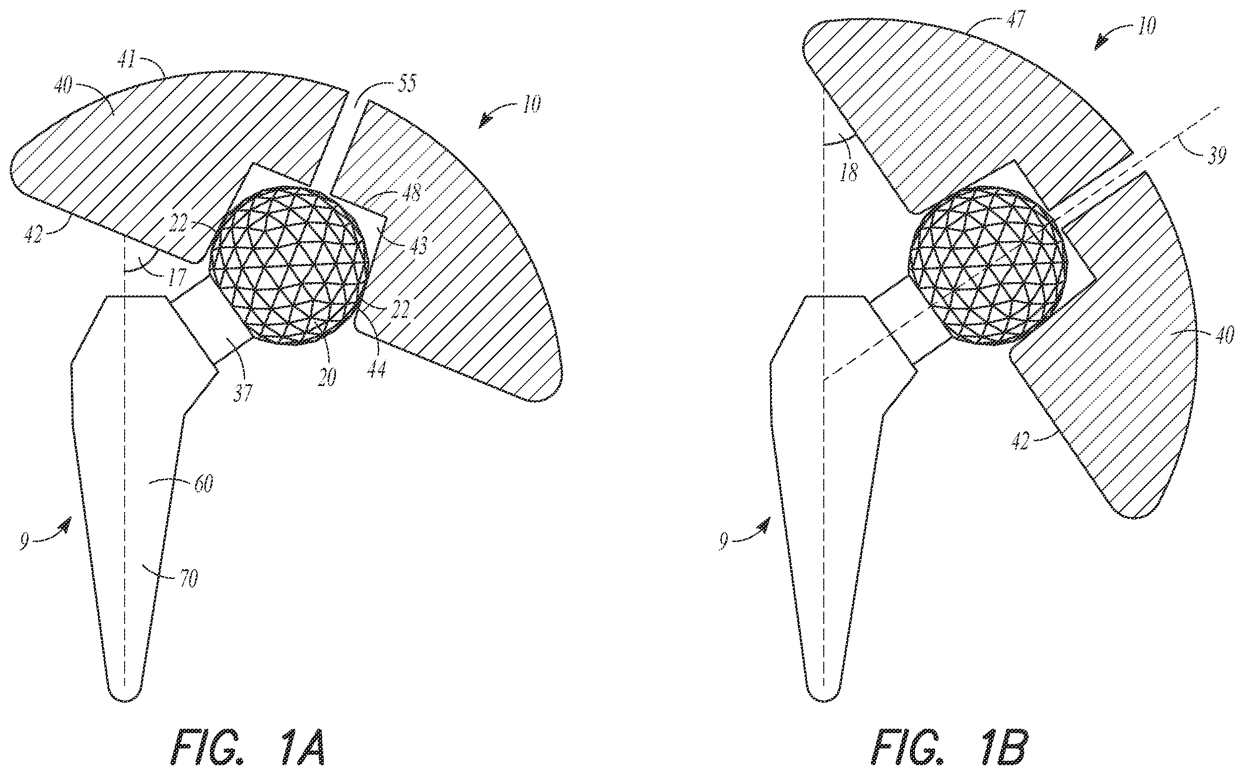 Patent US12564497 Figure 1 – Adjustable orthopedic connections