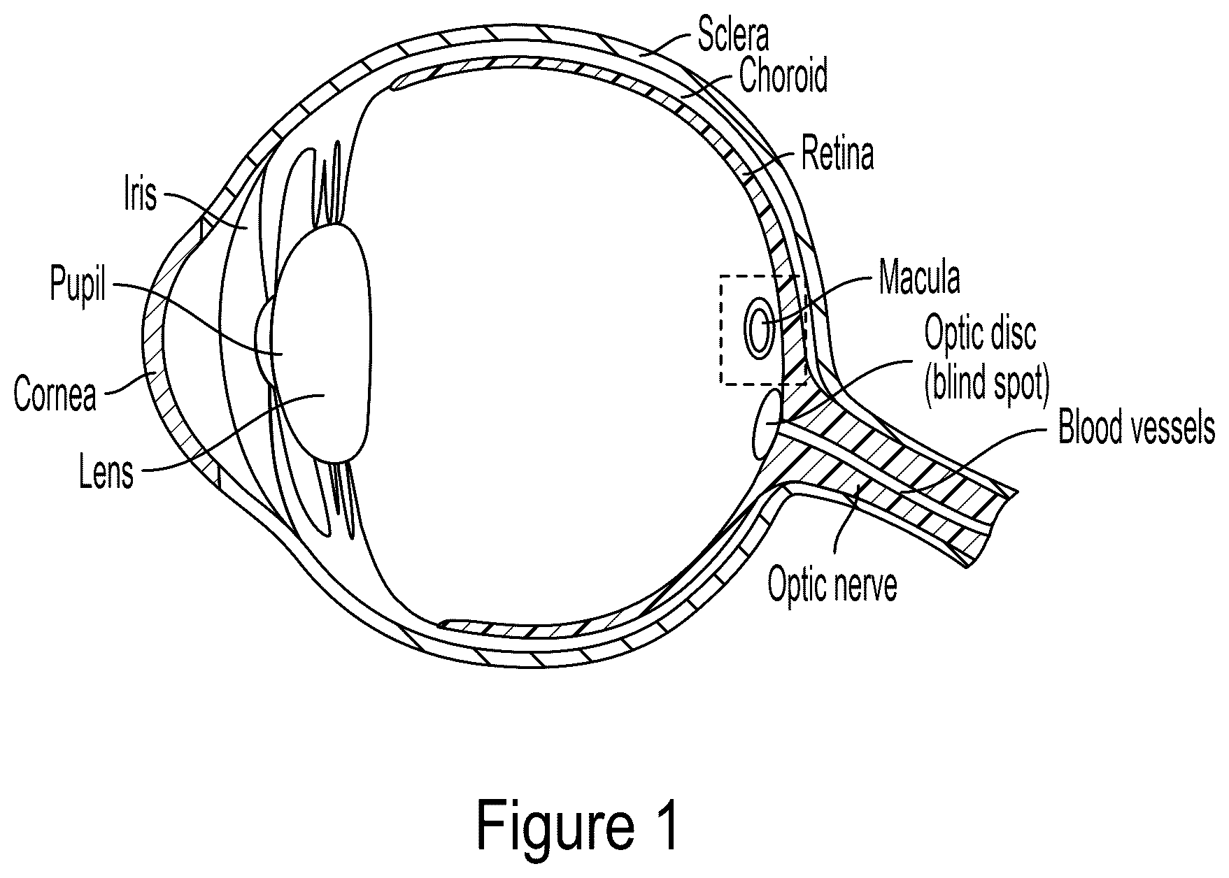 Patent US12564513 — Tool for macular elevation — Figure 1