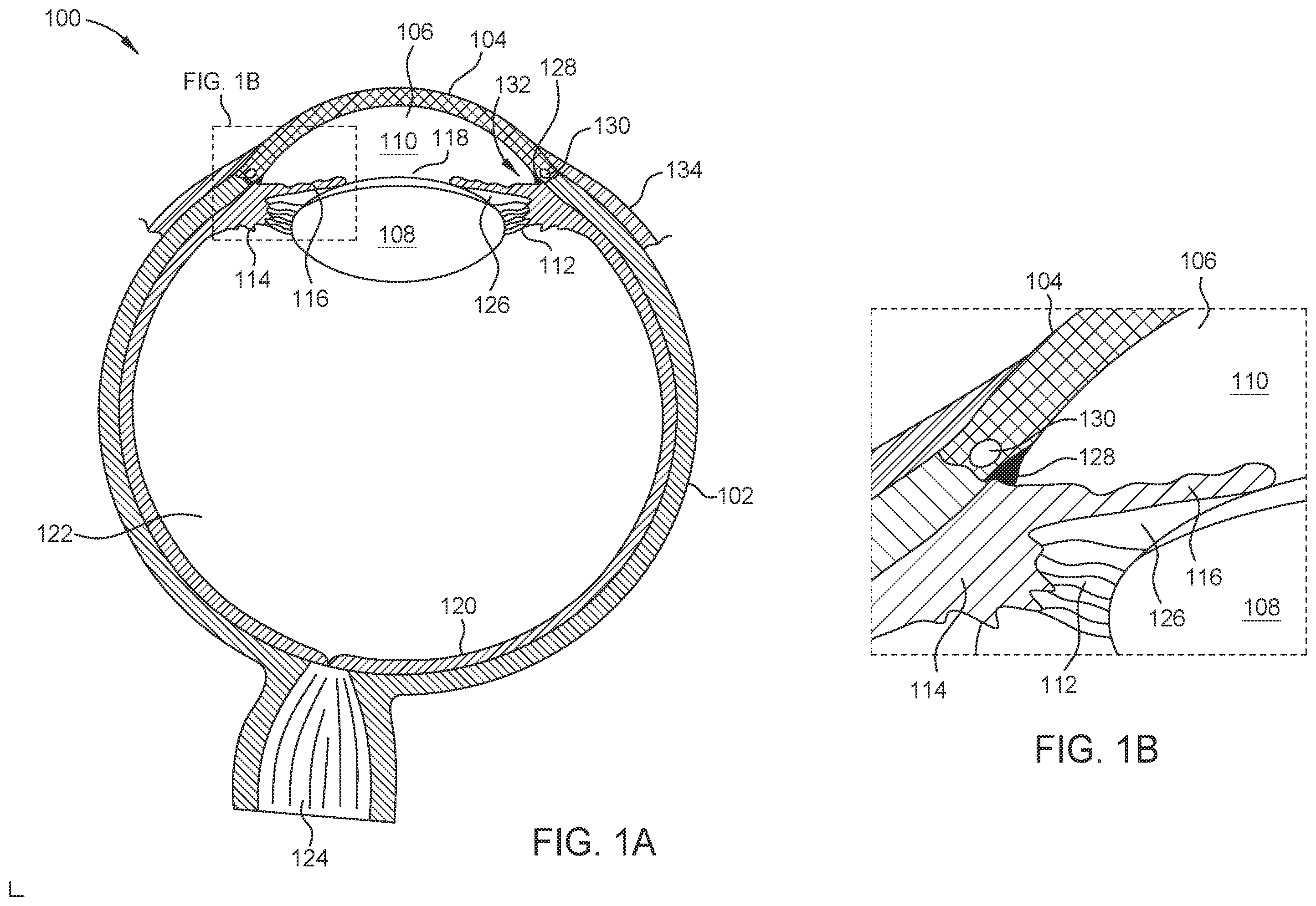 Patent US12564516 Figure 1 – Probe for laser ablation, illumination, and viscoelastic injection