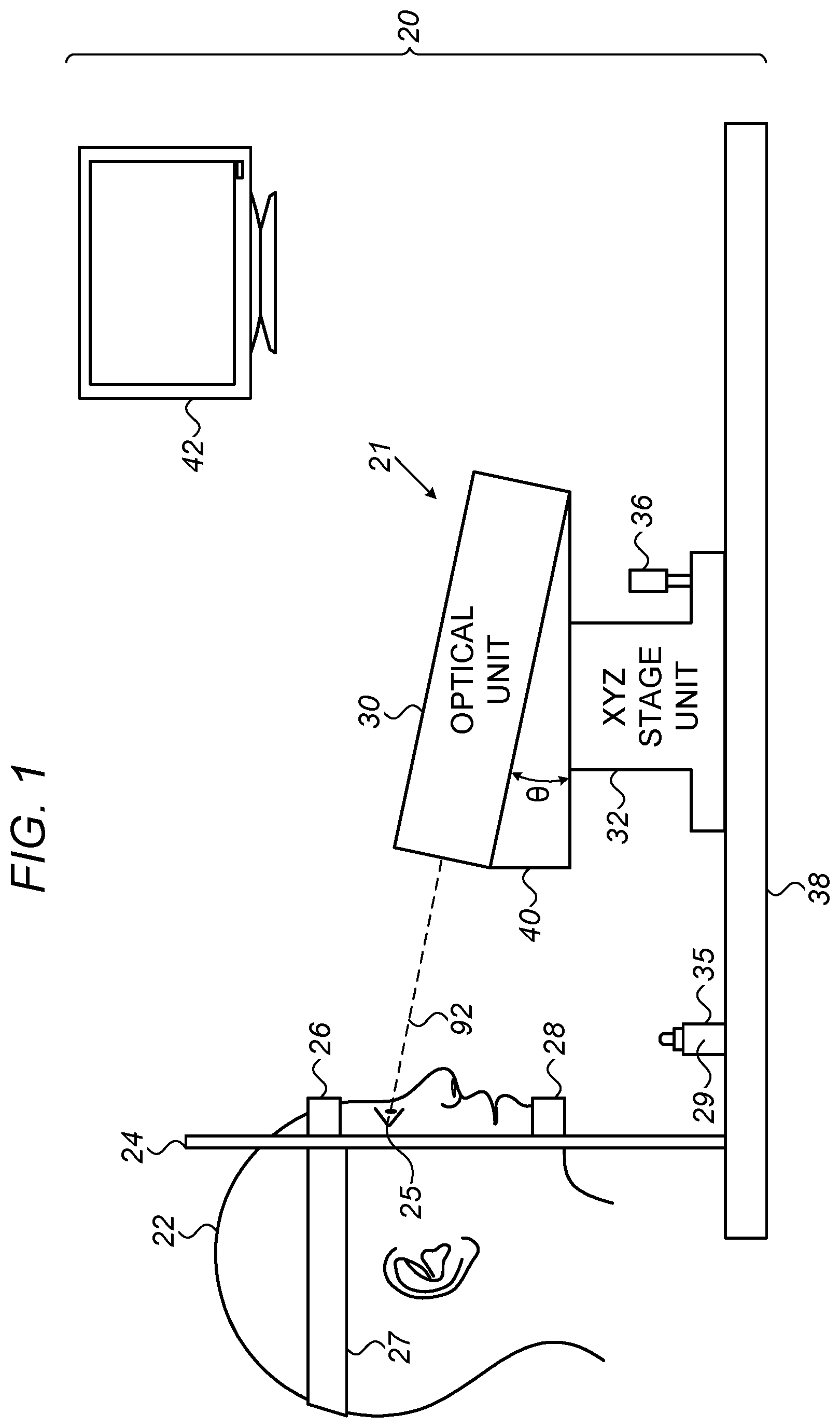 Patent US12564517 — Avoiding blood vessels during direct selective laser trabeculoplasty — Figure 1