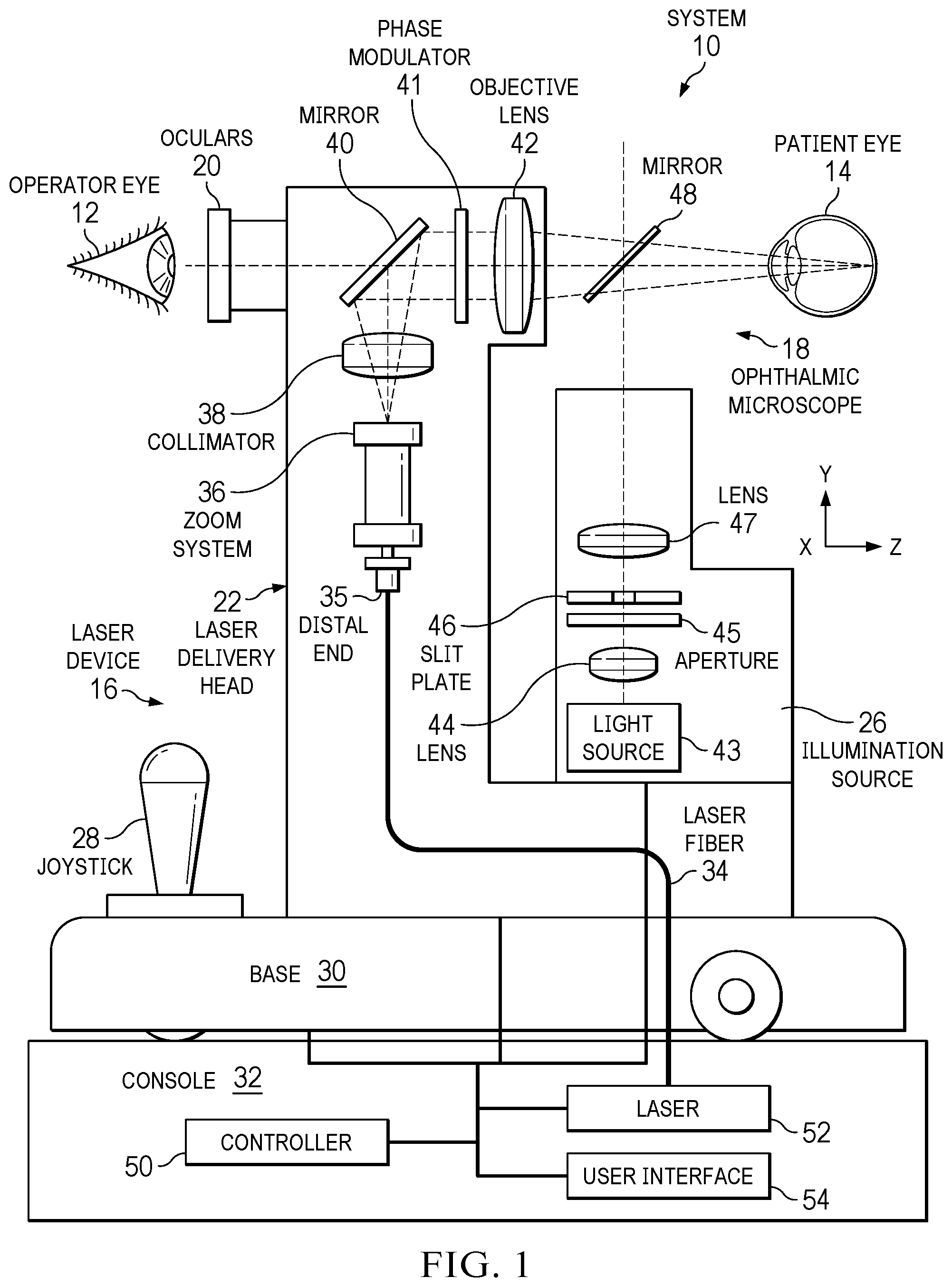 Patent US12564518 — Performing laser vitreolysis on an eye with an intraocular lens — Figure 1