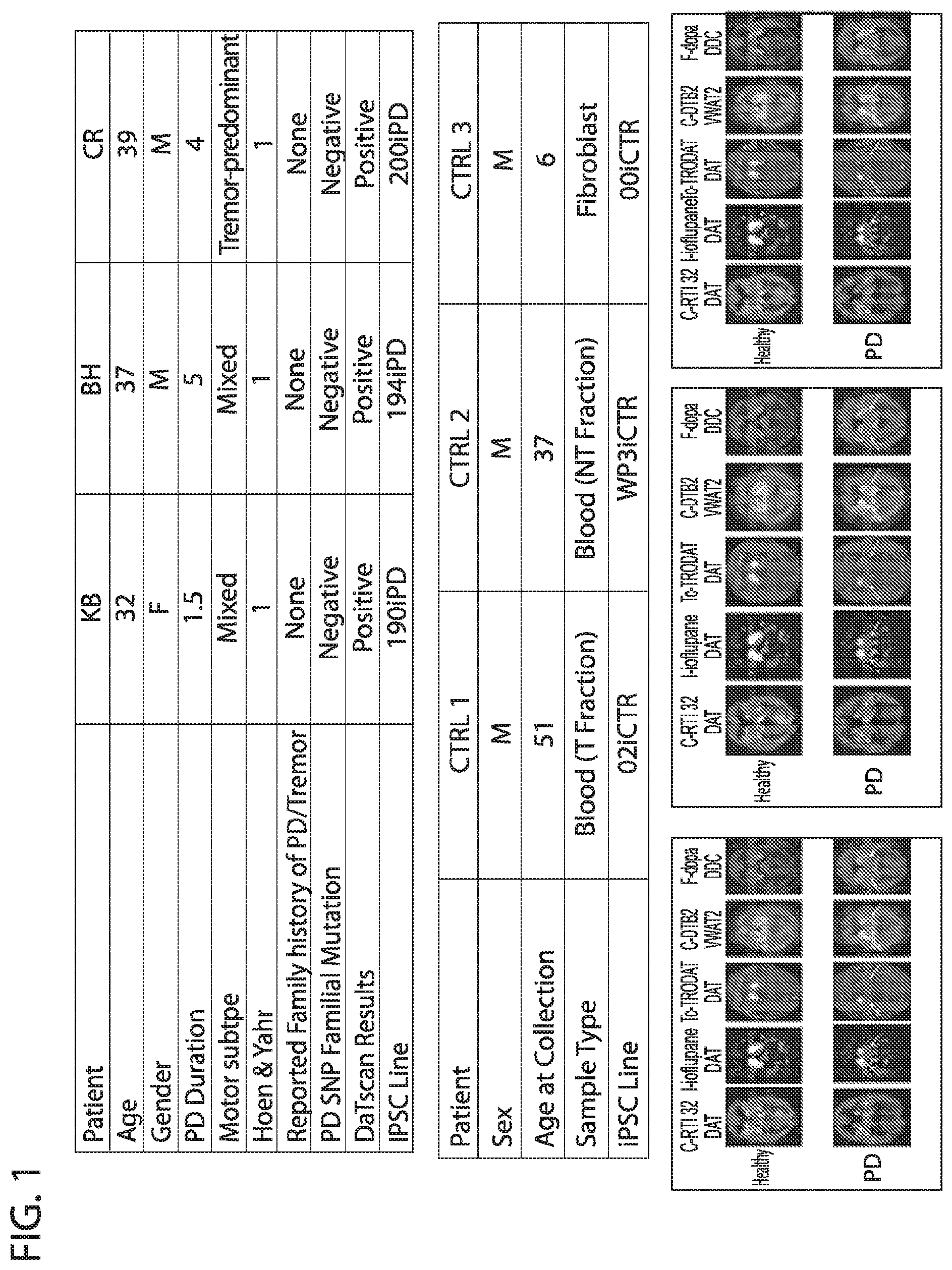Patent US12564568 — PKC pathway in Parkinson's Disease — Figure 1