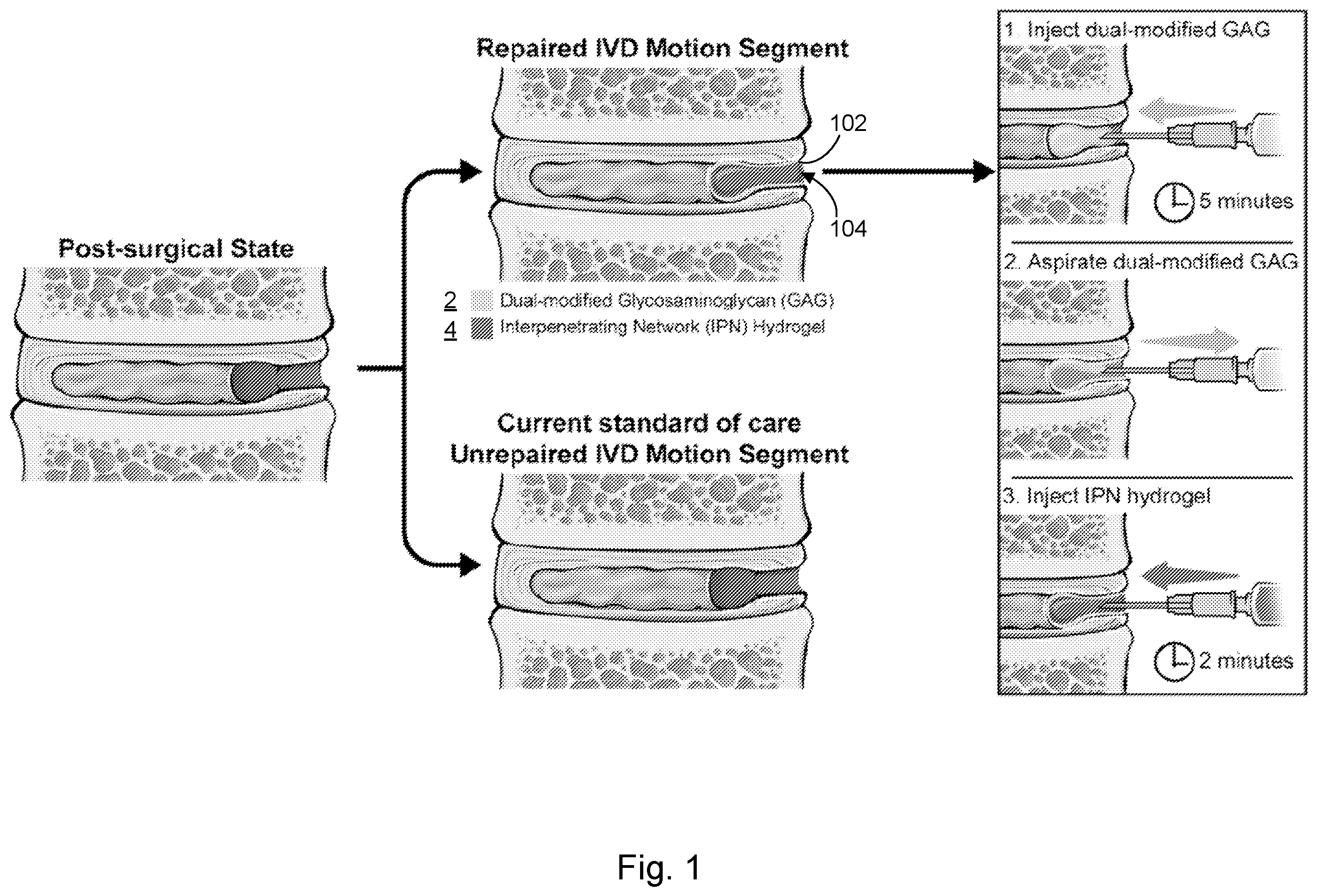 Patent US12564661 — Approach to repair tissue defects by bonding injectable gels to native soft tissues — Figure 1