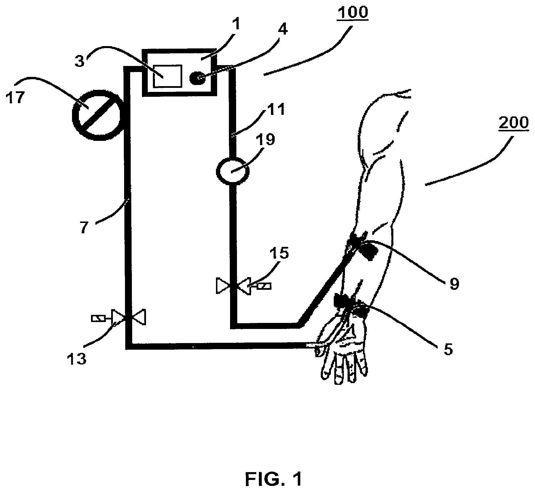 Patent US12564666 — Method for temporarily interrupting an extracorporeal blood treatment, control device and blood treatment apparatus — Figure 1