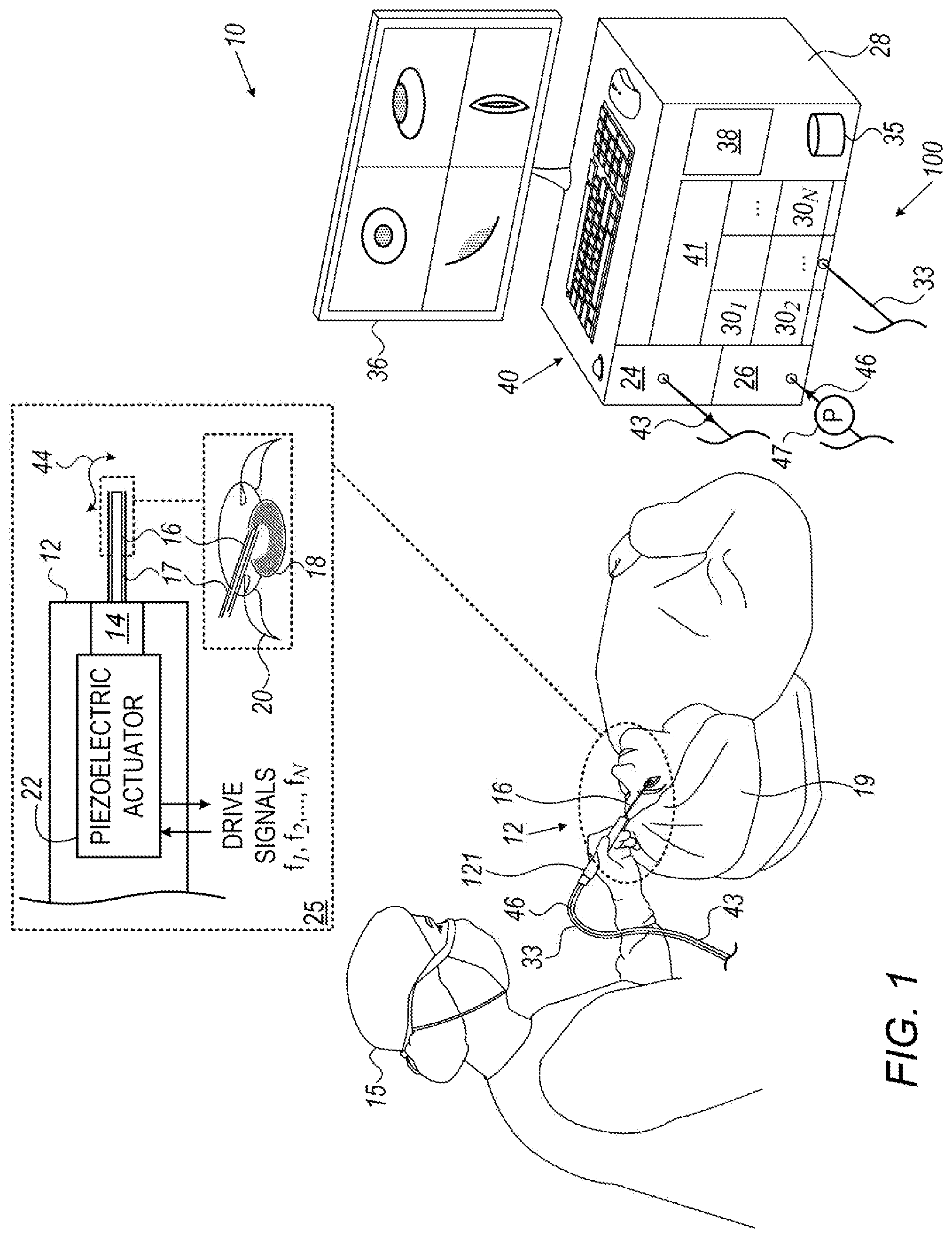 Patent US12564671 — Phacoemulsification irrigation apparatus with load cell and optical sensor — Figure 1