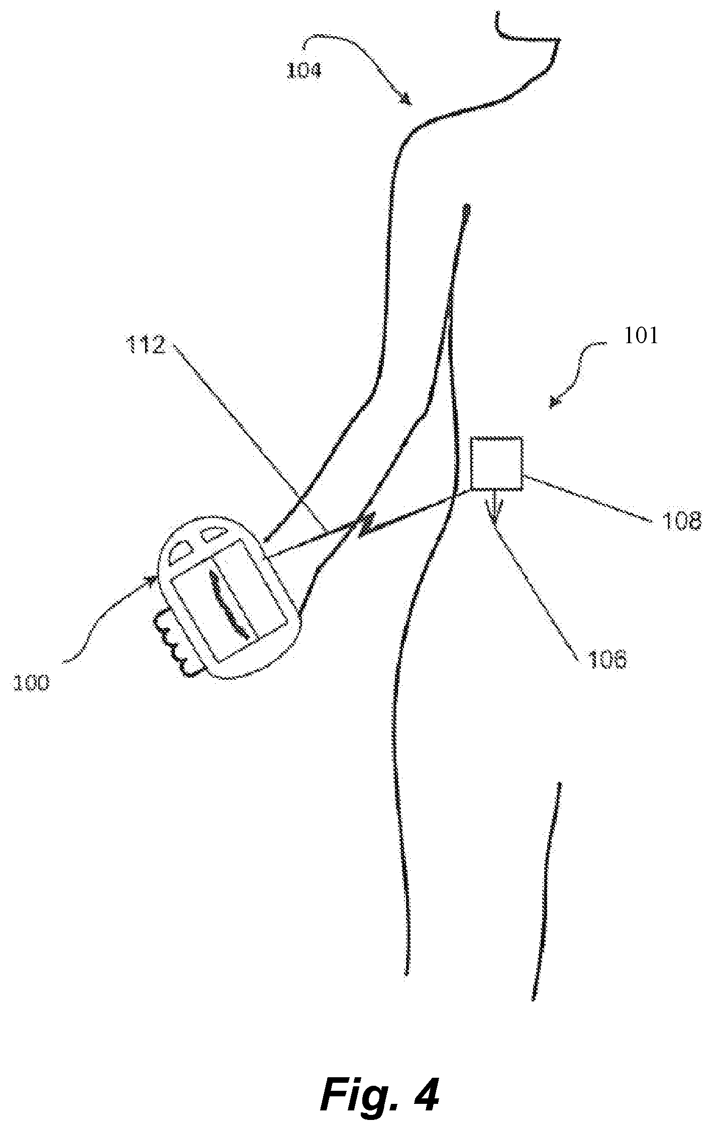 Patent US12564677 Figure 4 – Systems and methods for automated insulin delivery response to inaccurate or missed glucose values