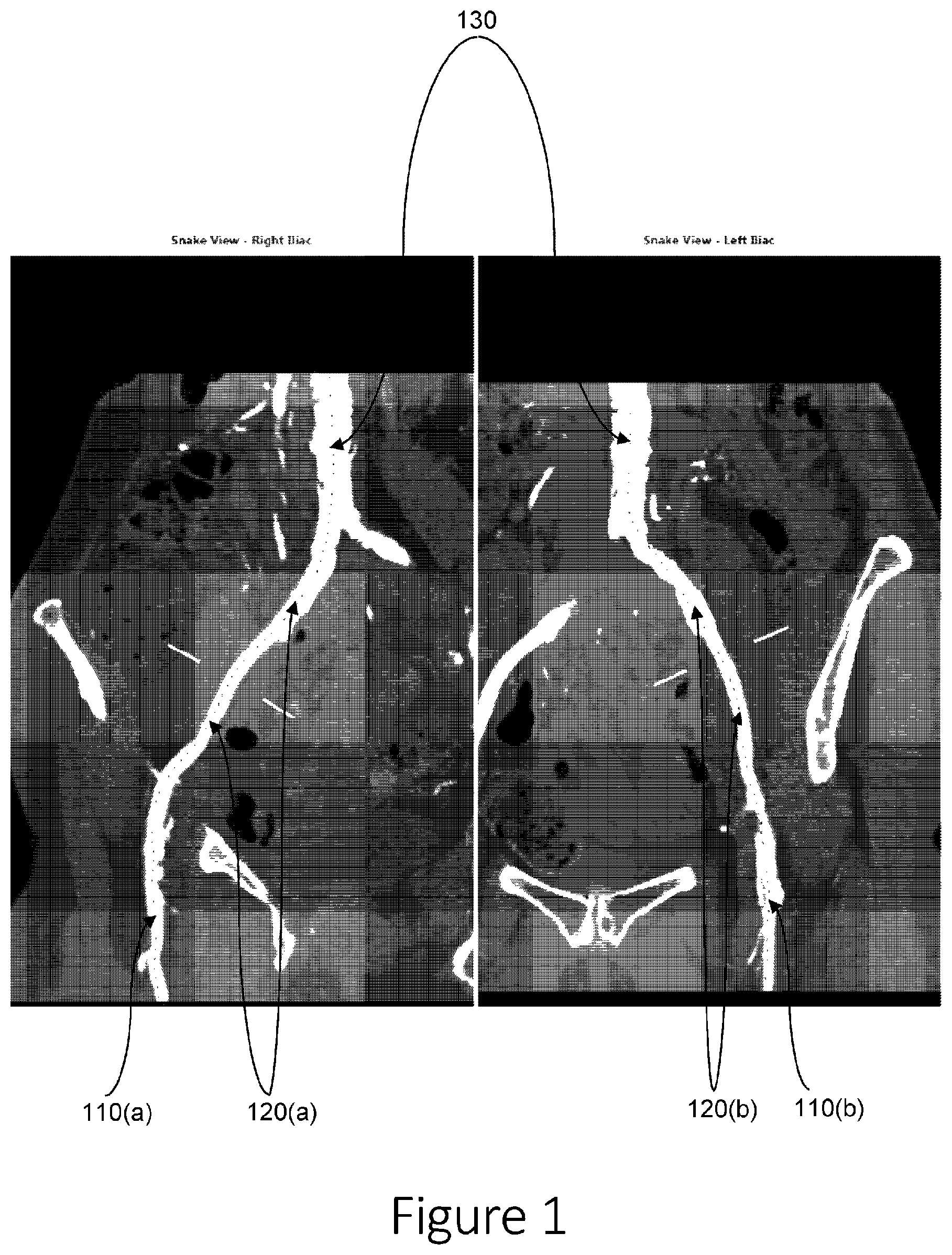 Patent US12564702 — Adjustable sheath device — Figure 1