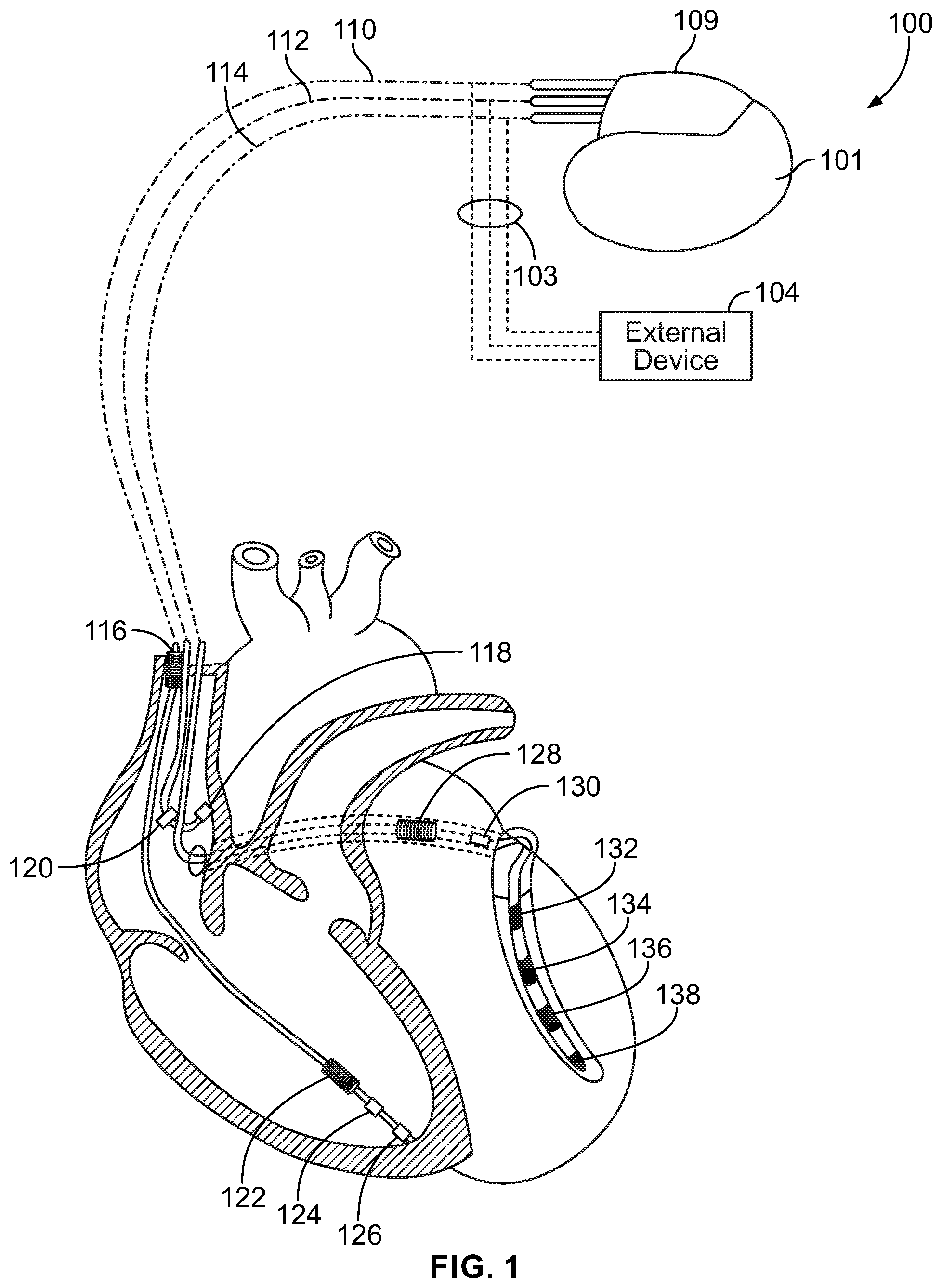 Patent US12564711 — Method and device for managing processing activity patterns — Figure 1