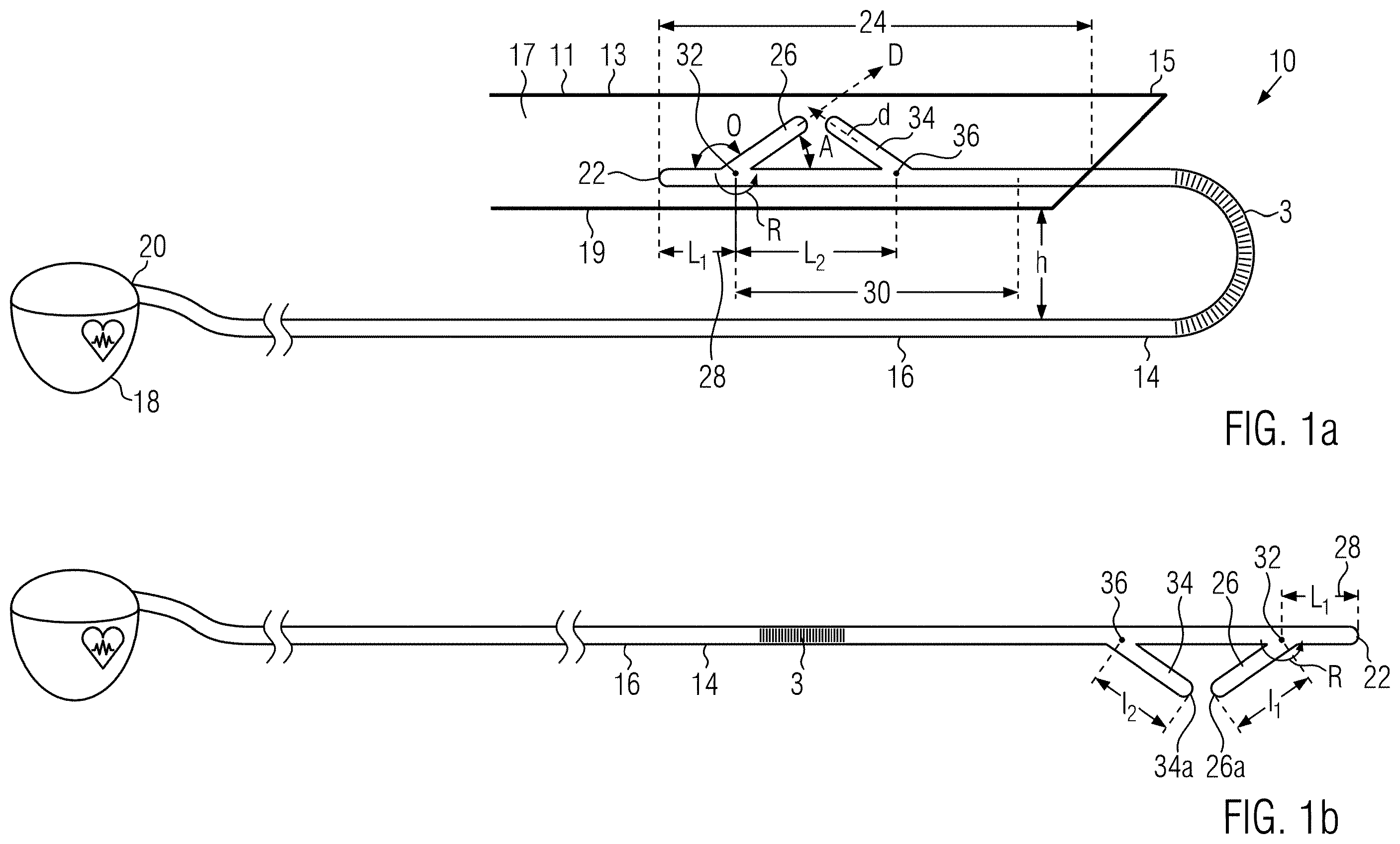 Patent US12564713 Figure 1 – Assembly of an implanting accessory and a flexible implantable stimulation lead