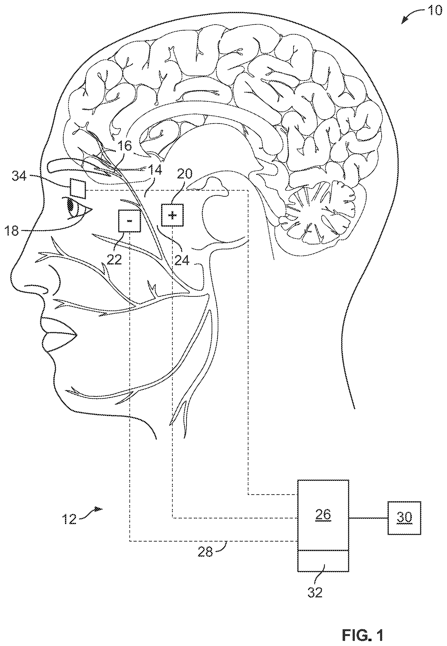 Patent US12564716 Figure 1 – Tonic eyelid closure and blink pacing device and method