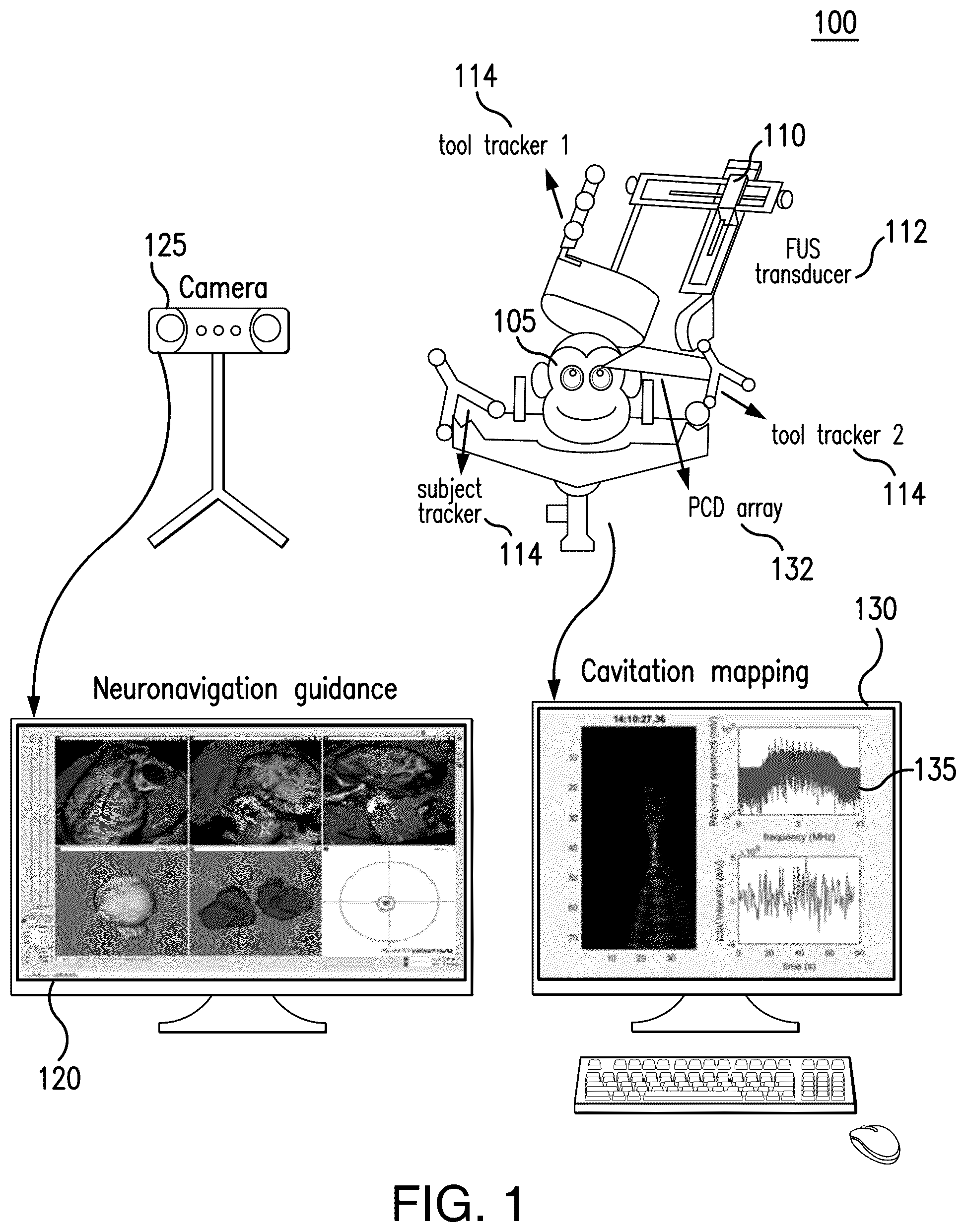 Patent US12564735 — Systems and methods for modulation and mapping of brain tissue using an ultrasound assembly — Figure 1