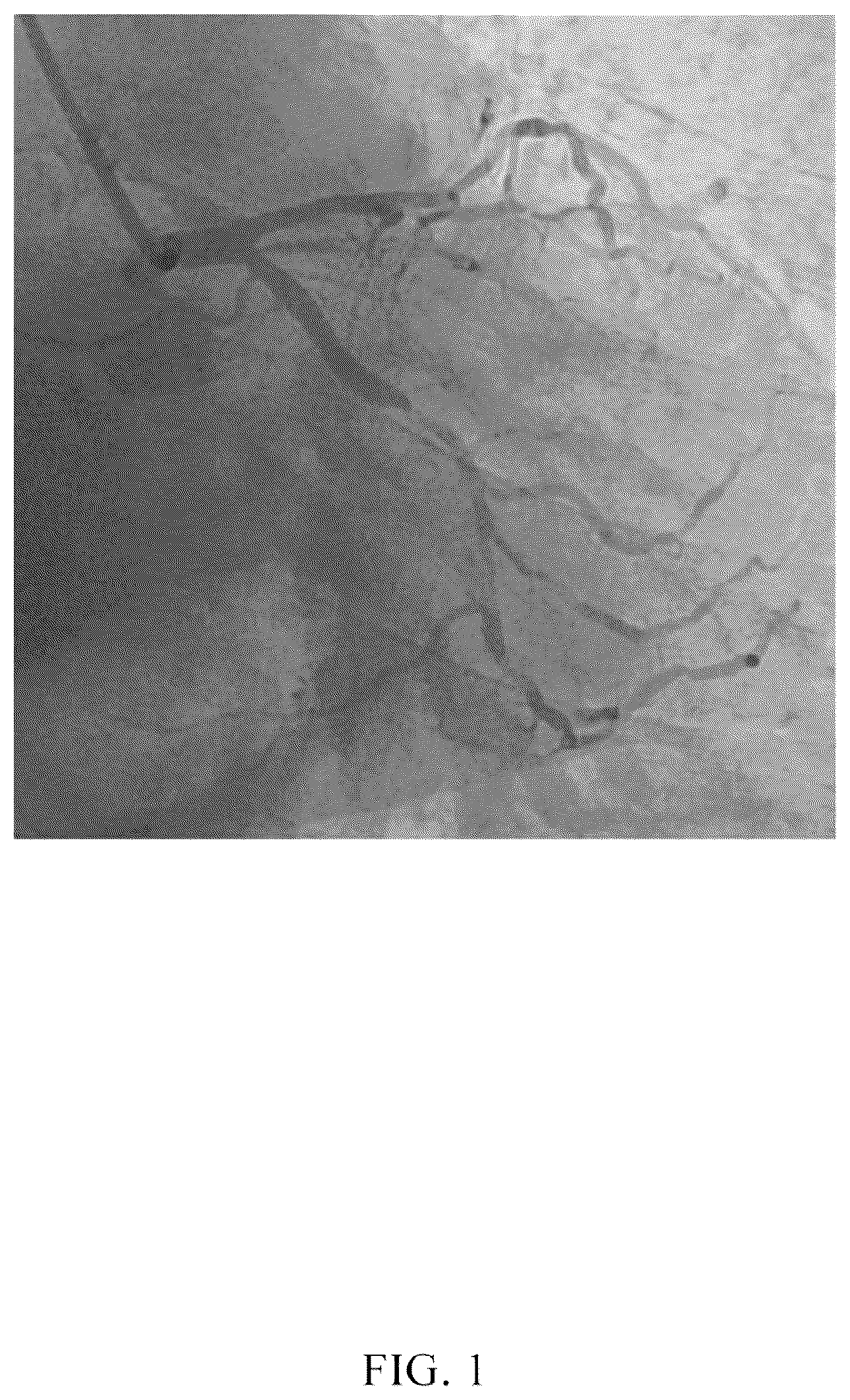 Patent US12567152 — Blood vessel image segmenting method and apparatus using plurality of prediction results — Figure 1