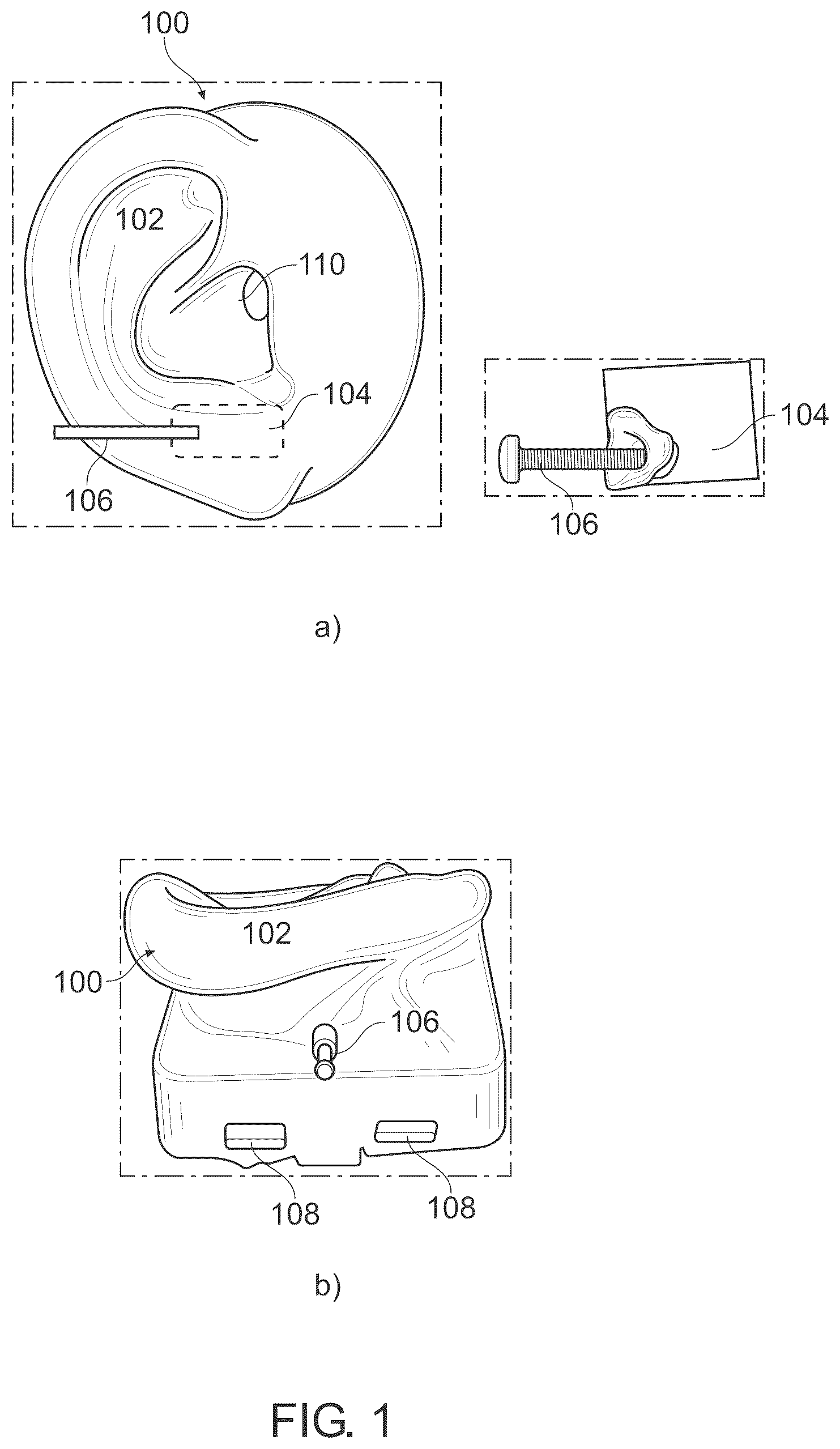 Patent US12568340 — Ear model unit for electroacoustic testing and a method for performing electroacoustic testing of a hearing device — Figure 1