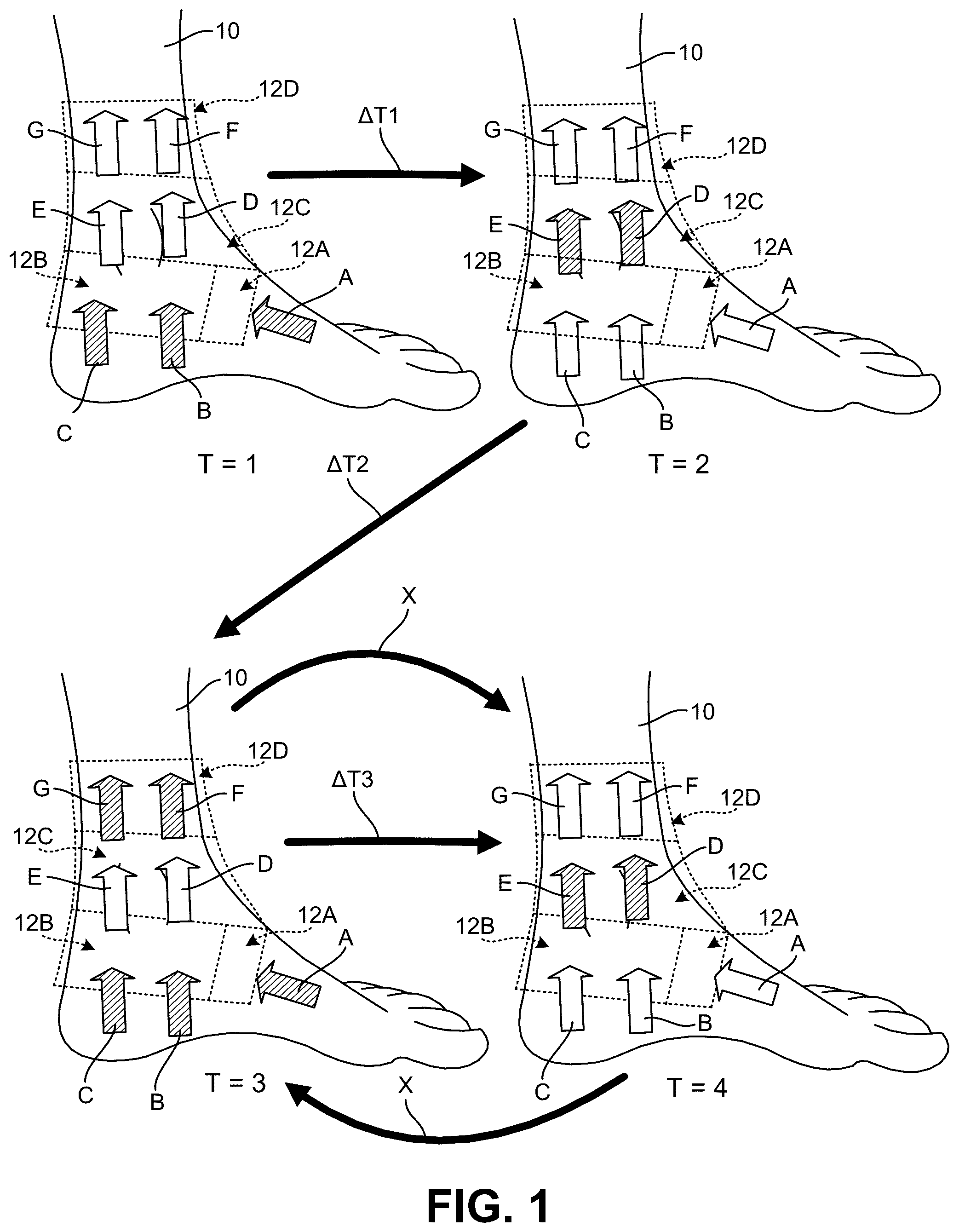 Patent US12569025 Figure 1 – Footwear structures providing compression and thermal treatment