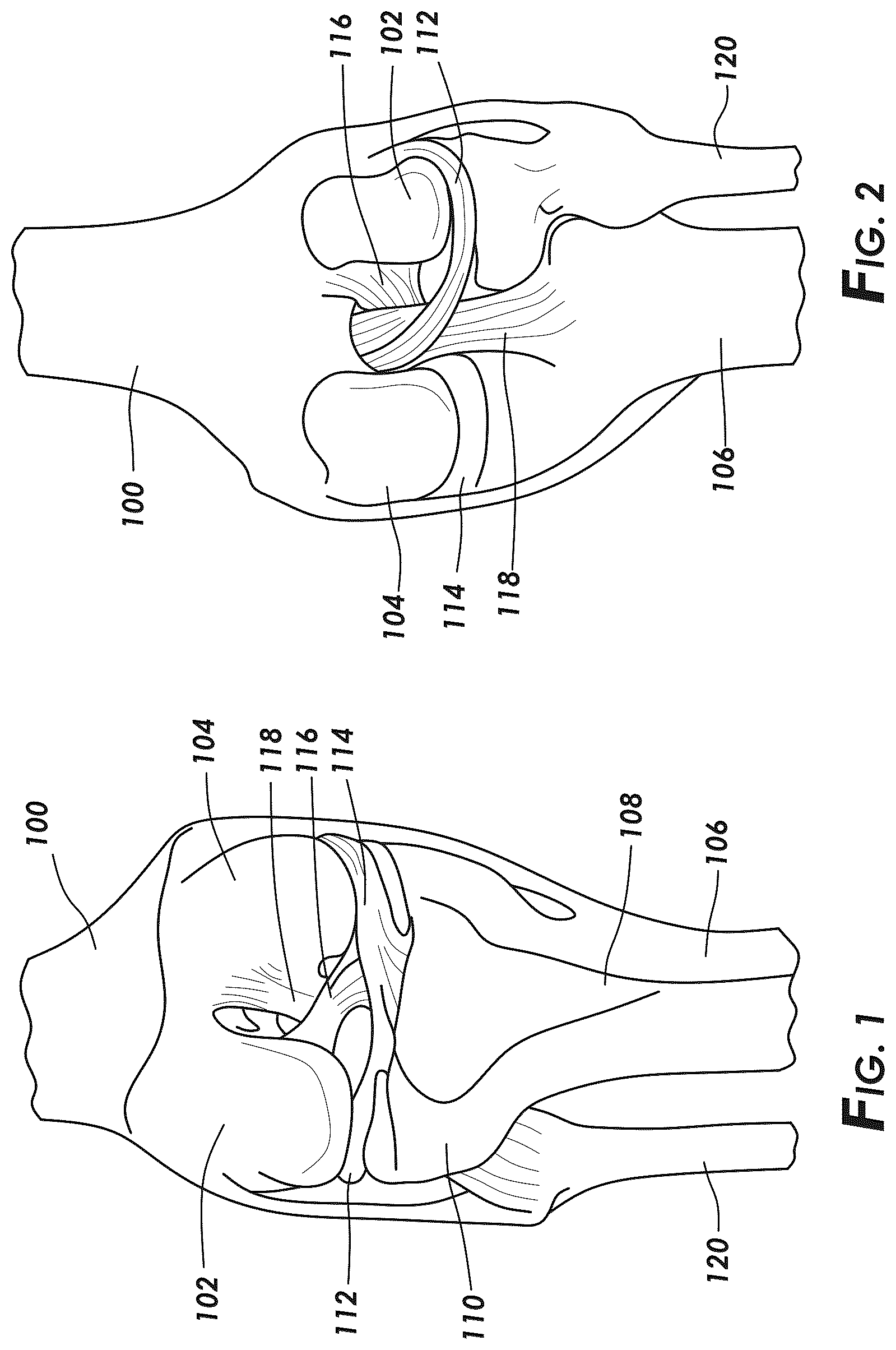 Patent US12569114 — Methods and systems for intraoperatively selecting and displaying cross-sectional images — Figure 1
