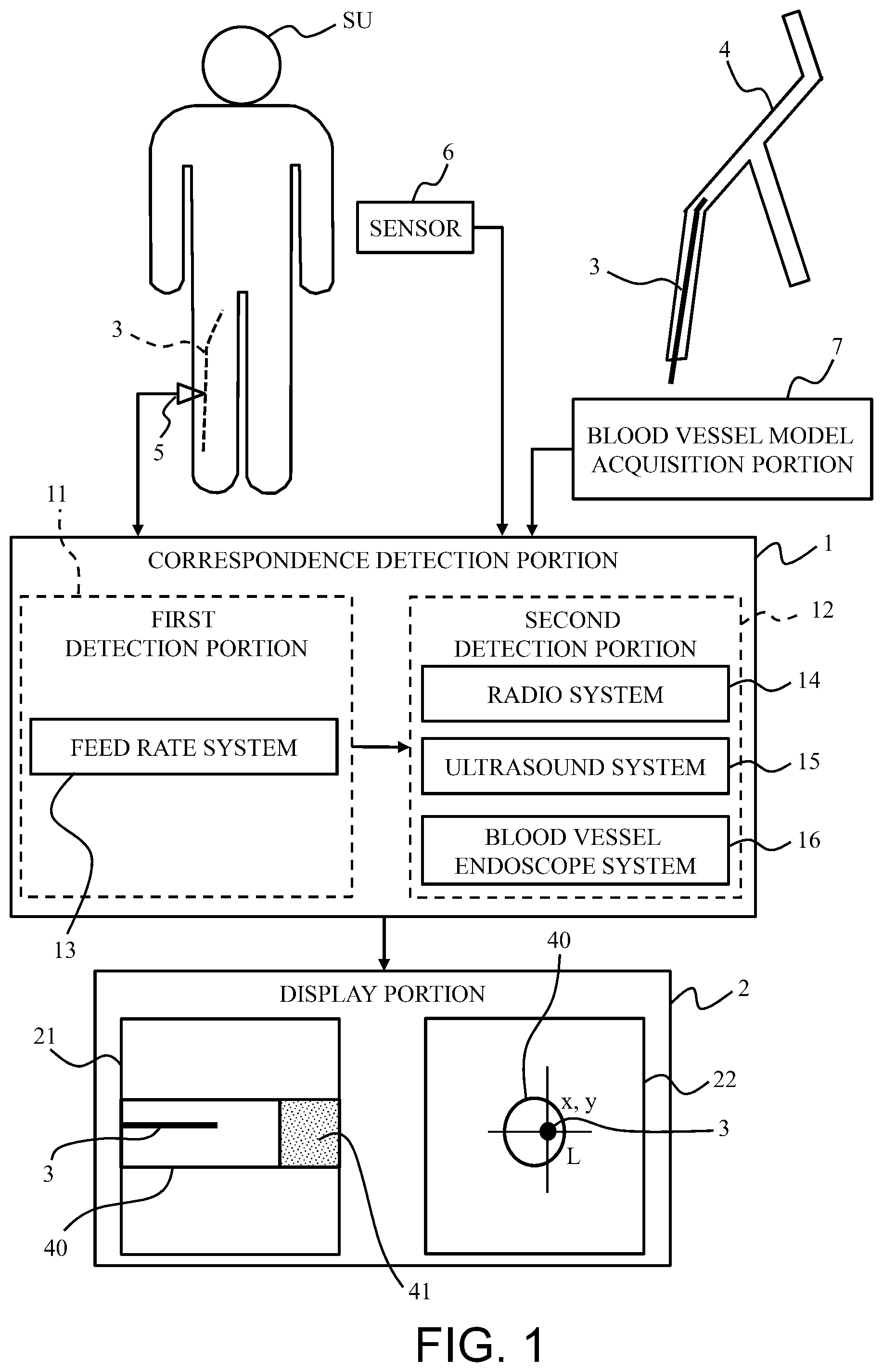 Patent US12569160 Figure 1 – System and method for detecting position of long medical device