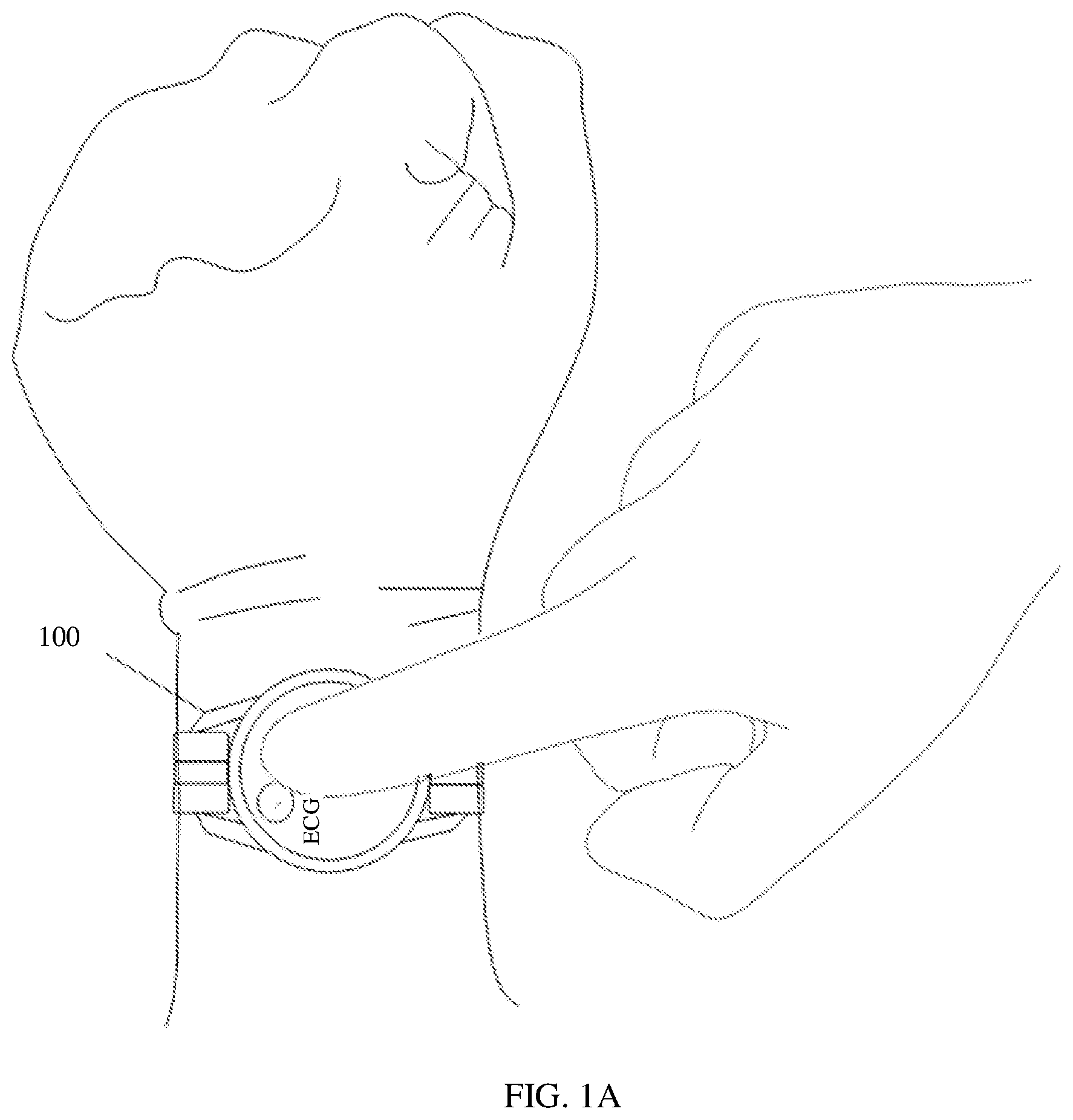 Patent US12569181 — ECG waveform display method and medium thereof, and electronic device — Figure 1