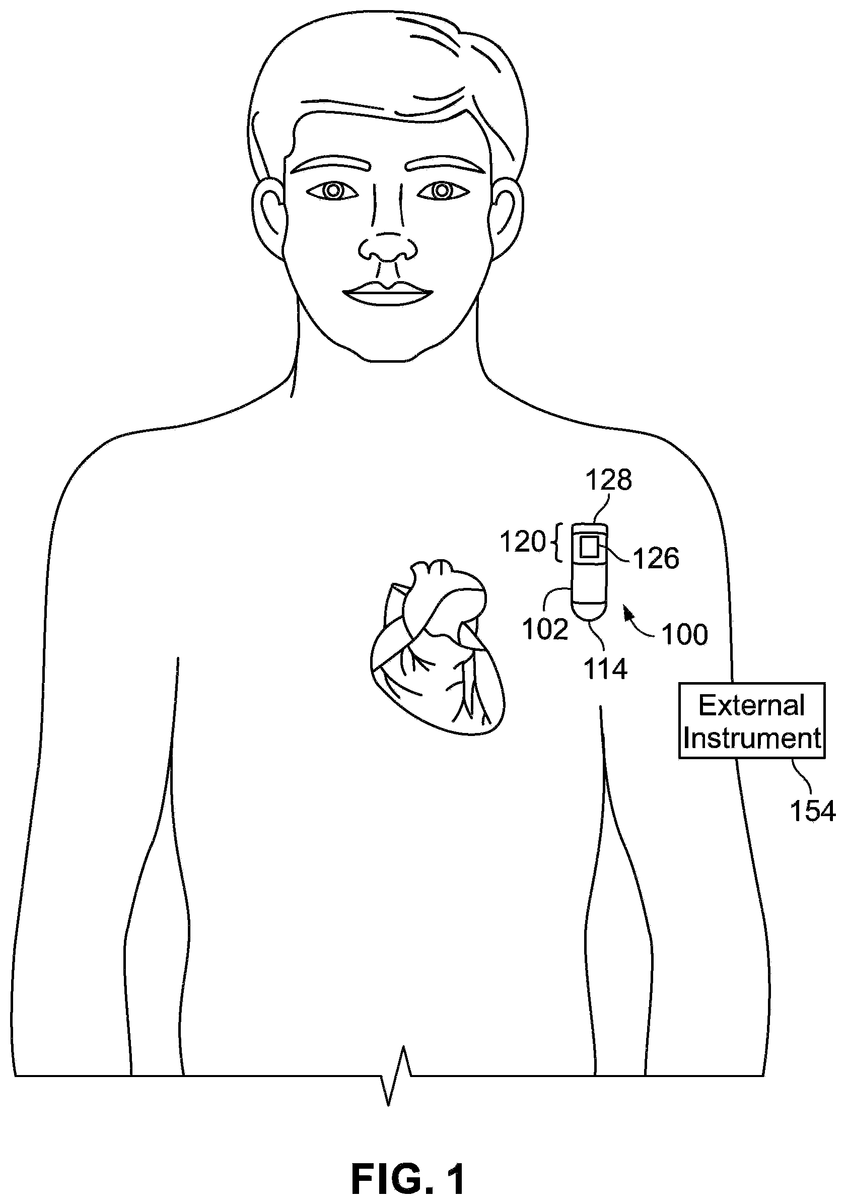 Patent US12569205 — Implantable medical device data and diagnostics management system method using machine-learning architecture — Figure 1