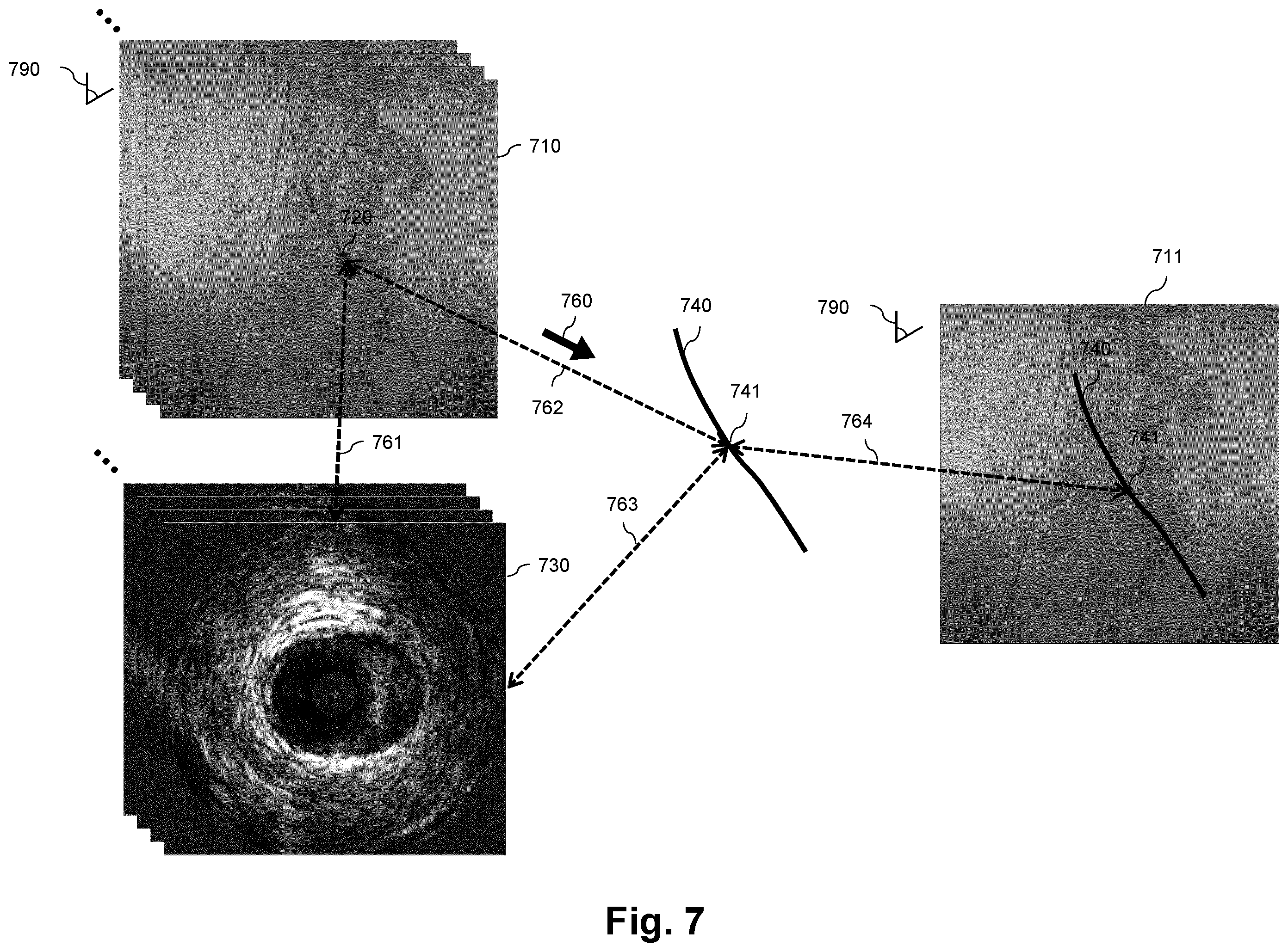 Patent US12569210 Figure 7 – Coregistration reliability with extraluminal image and intraluminal data