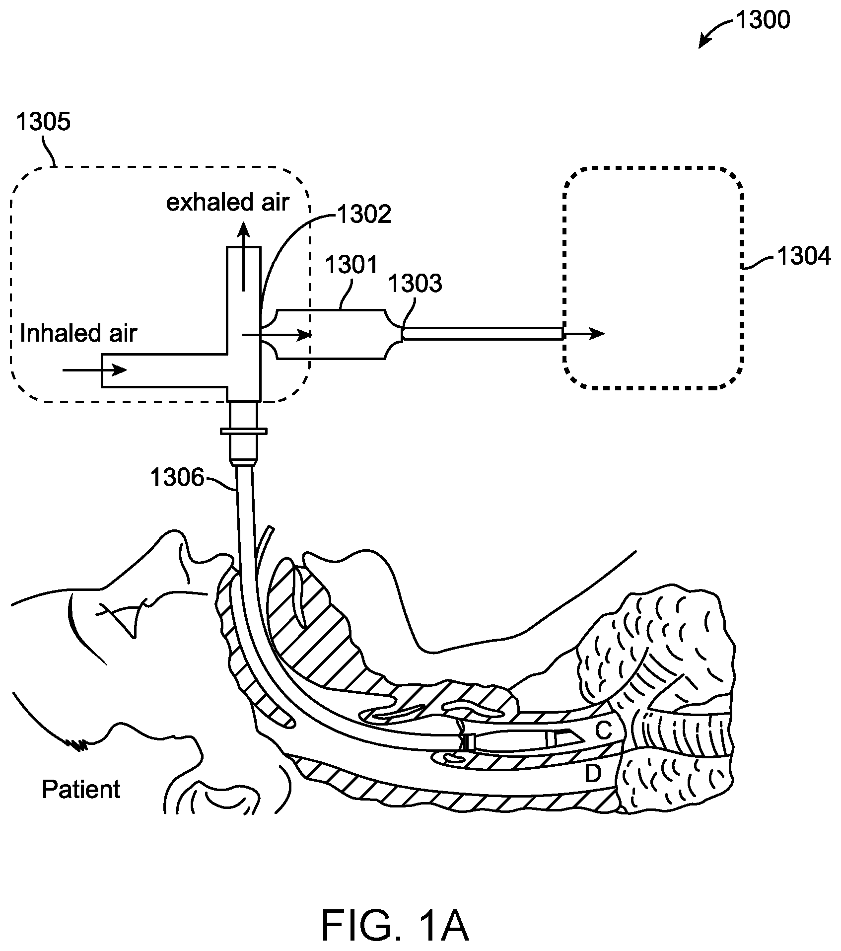Patent US12569229 — Capturing truncated proteoforms in exhaled breath for diagnosis and treatment of diseases — Figure 1