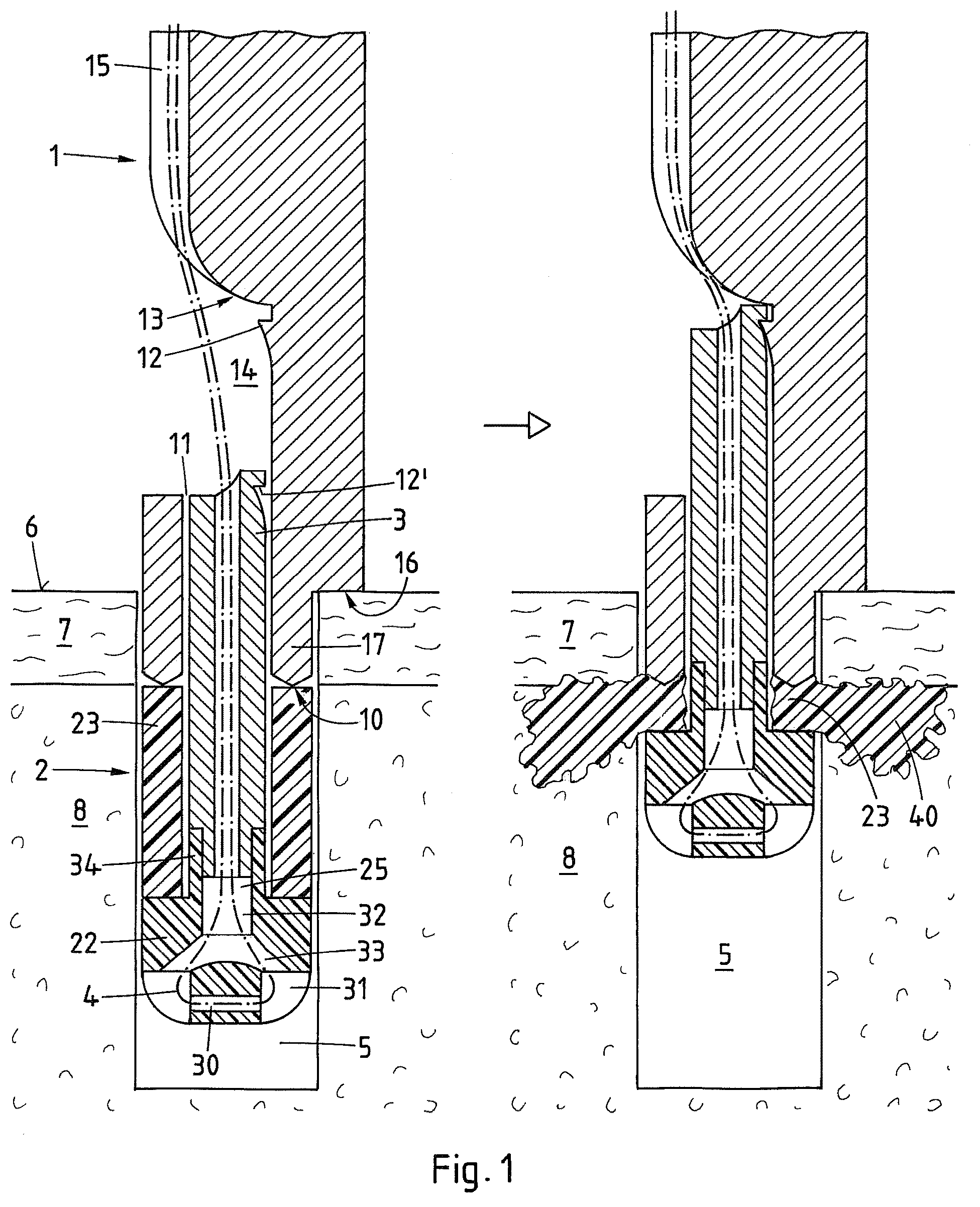 Patent US12569242 — Device and method for fixating a suture anchor in hard tissue — Figure 1
