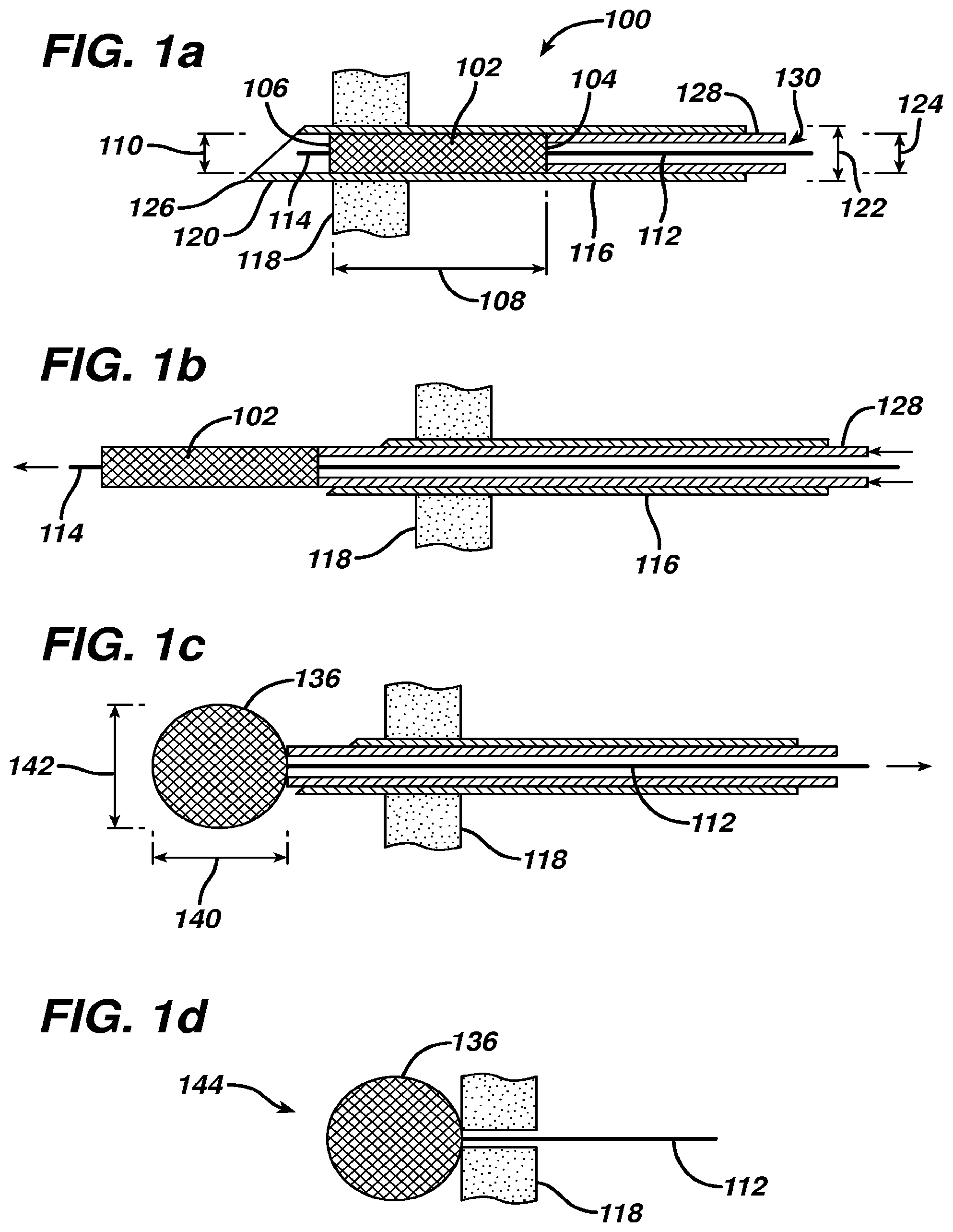 Patent US12569246 Figure 1 – Methods and devices for repairing and anchoring damaged tissue