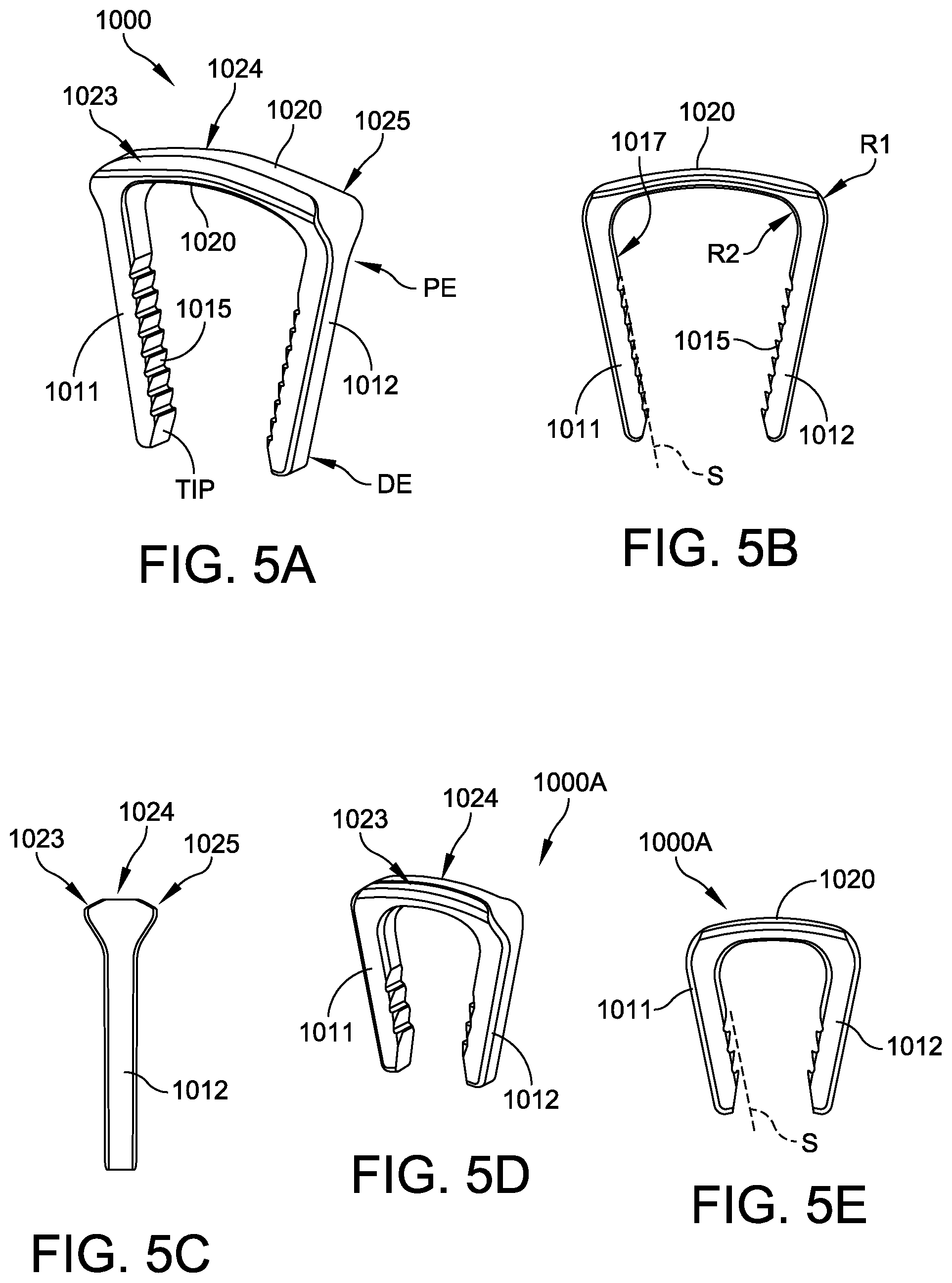 Patent US12569248 Figure 11 – Orthopedic staple and related instruments
