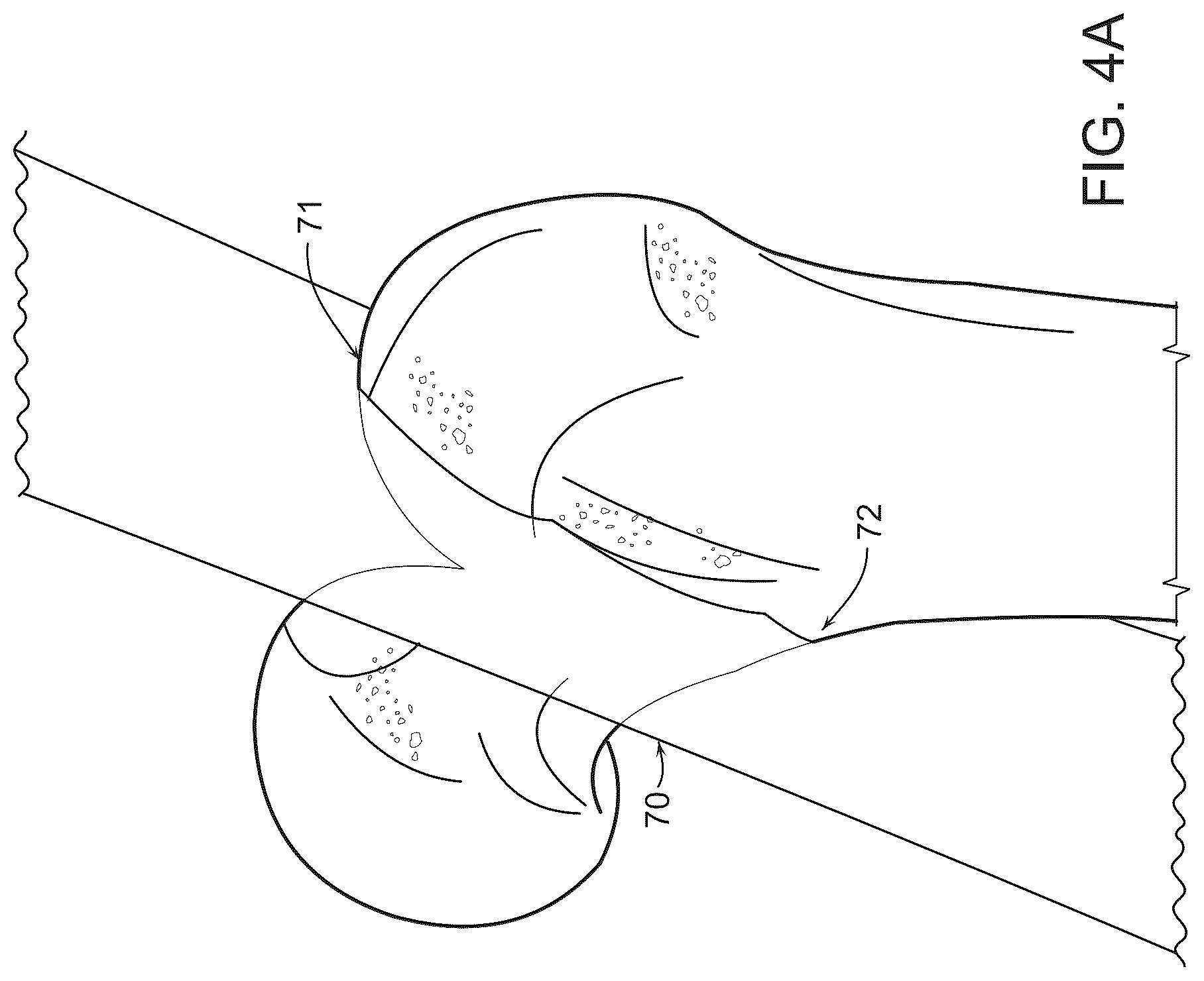 Patent US12569260 Figure 4 – Controls for power tools or instruments including bone saws and drills including safety and directional control and haptic feedback