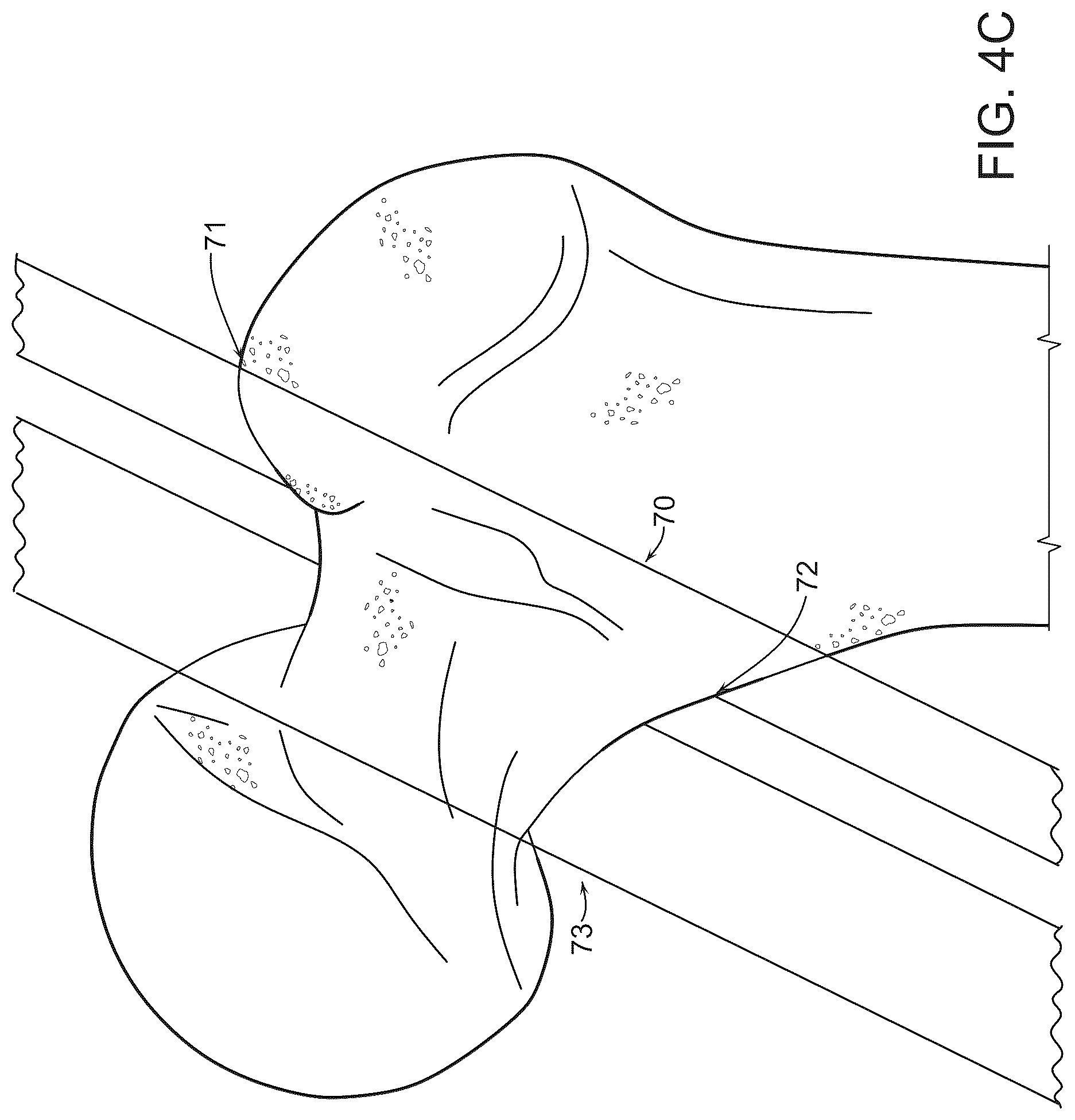 Patent US12569260 Figure 6 – Controls for power tools or instruments including bone saws and drills including safety and directional control and haptic feedback
