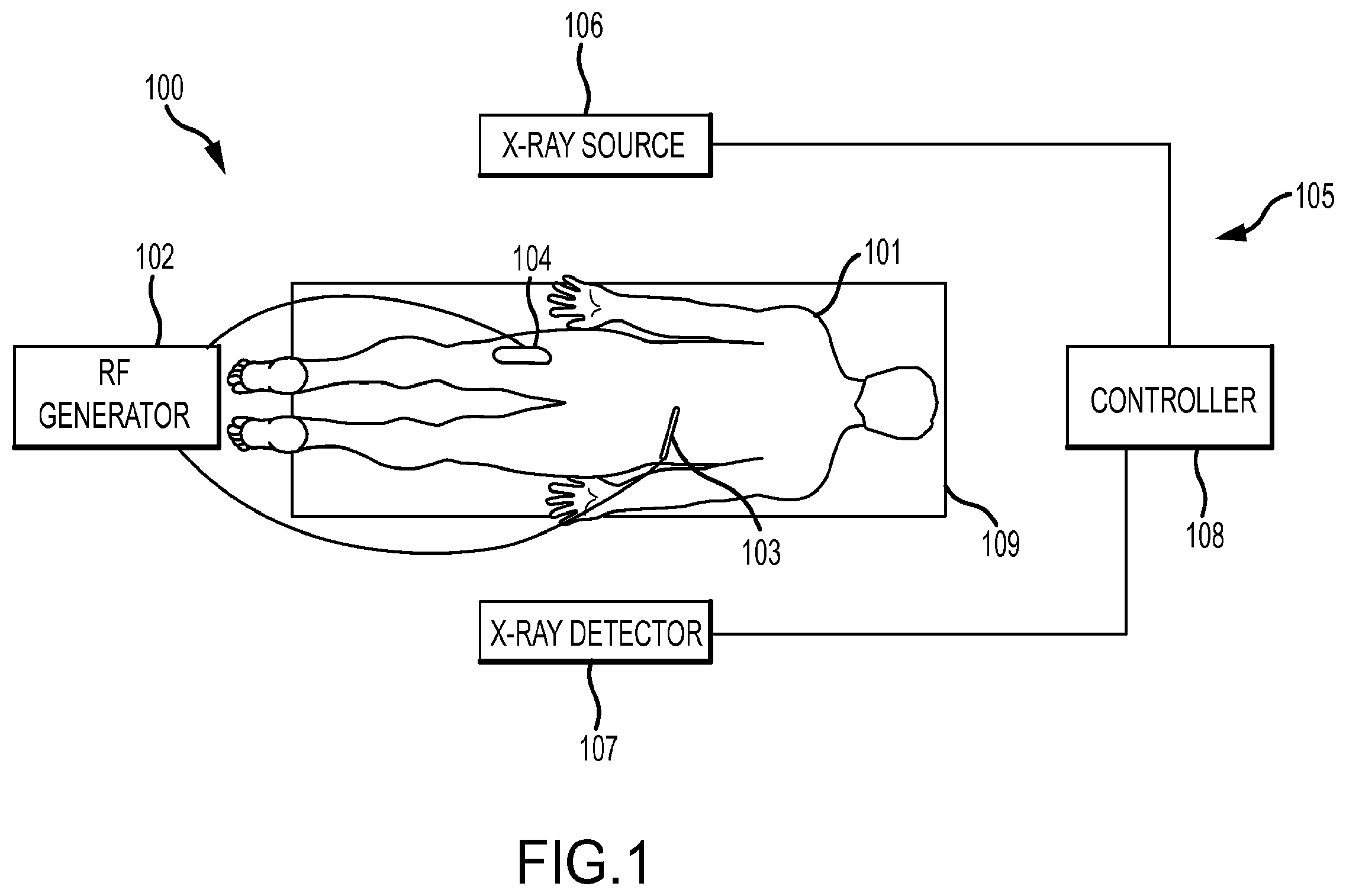 Patent US12569293 — Systems for radiofrequency neurotomy — Figure 1