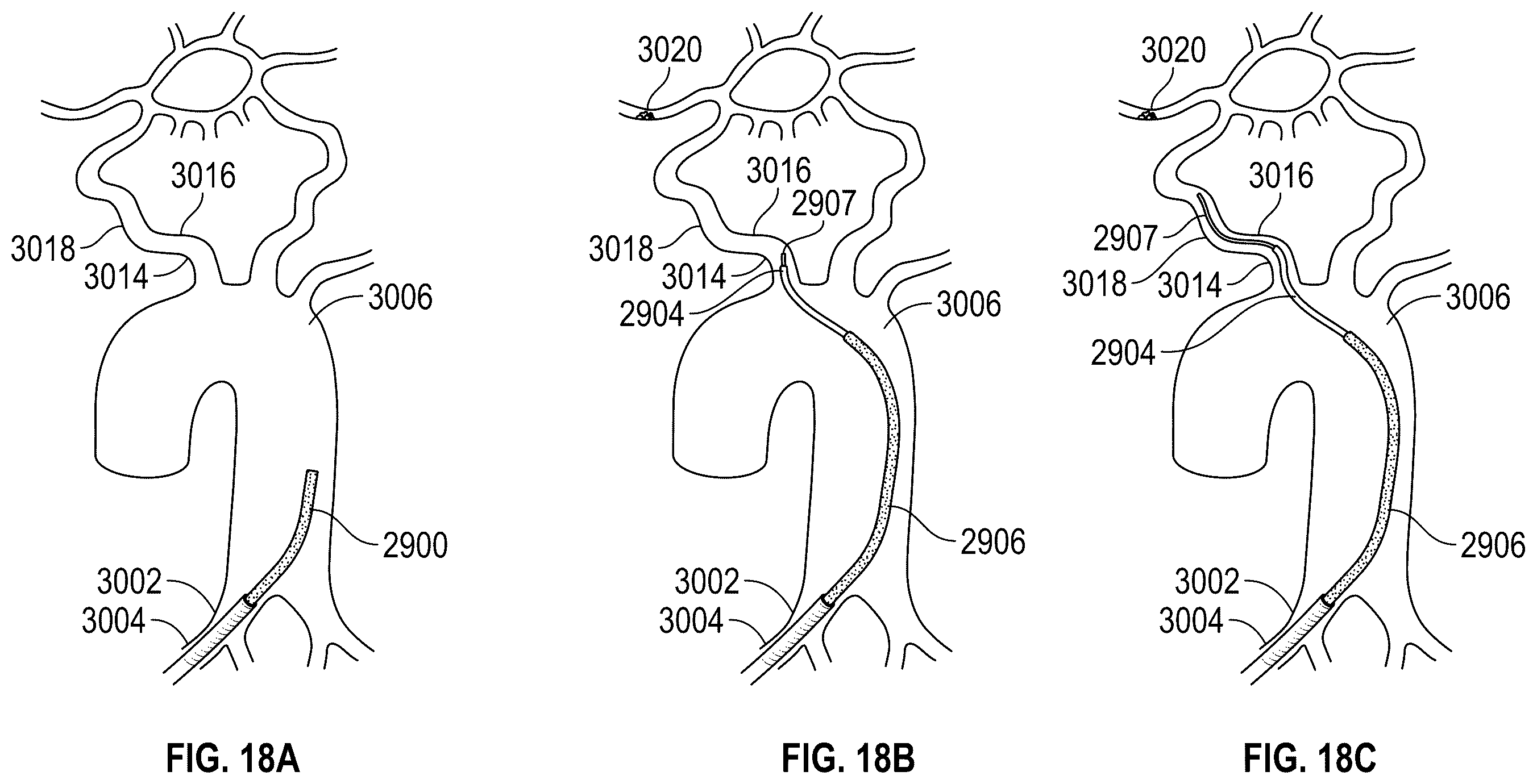 Patent US12569308 Figure 20 – User interface for rotational device movement