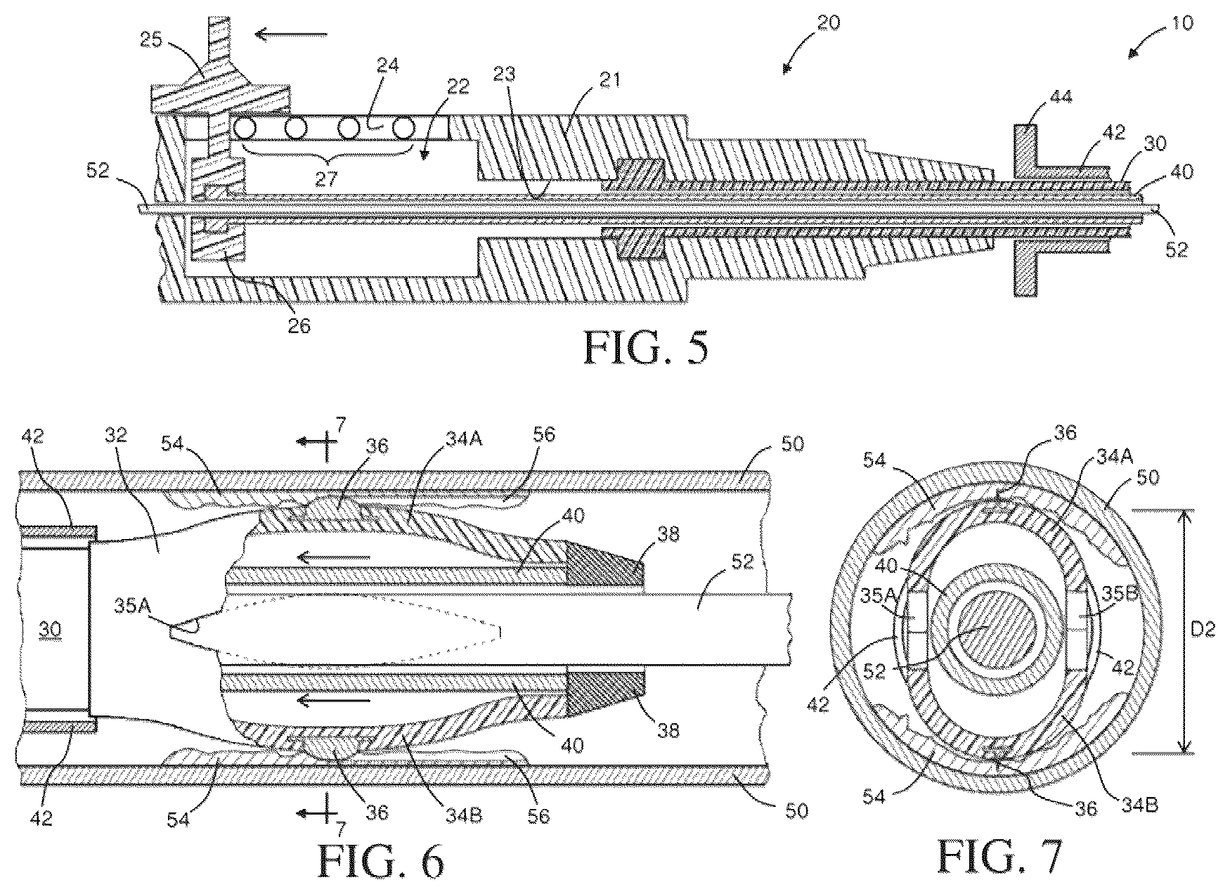 Patent US12569327 Figure 3 – Intravascular catheter having an expandable incising portion and embolic protection device