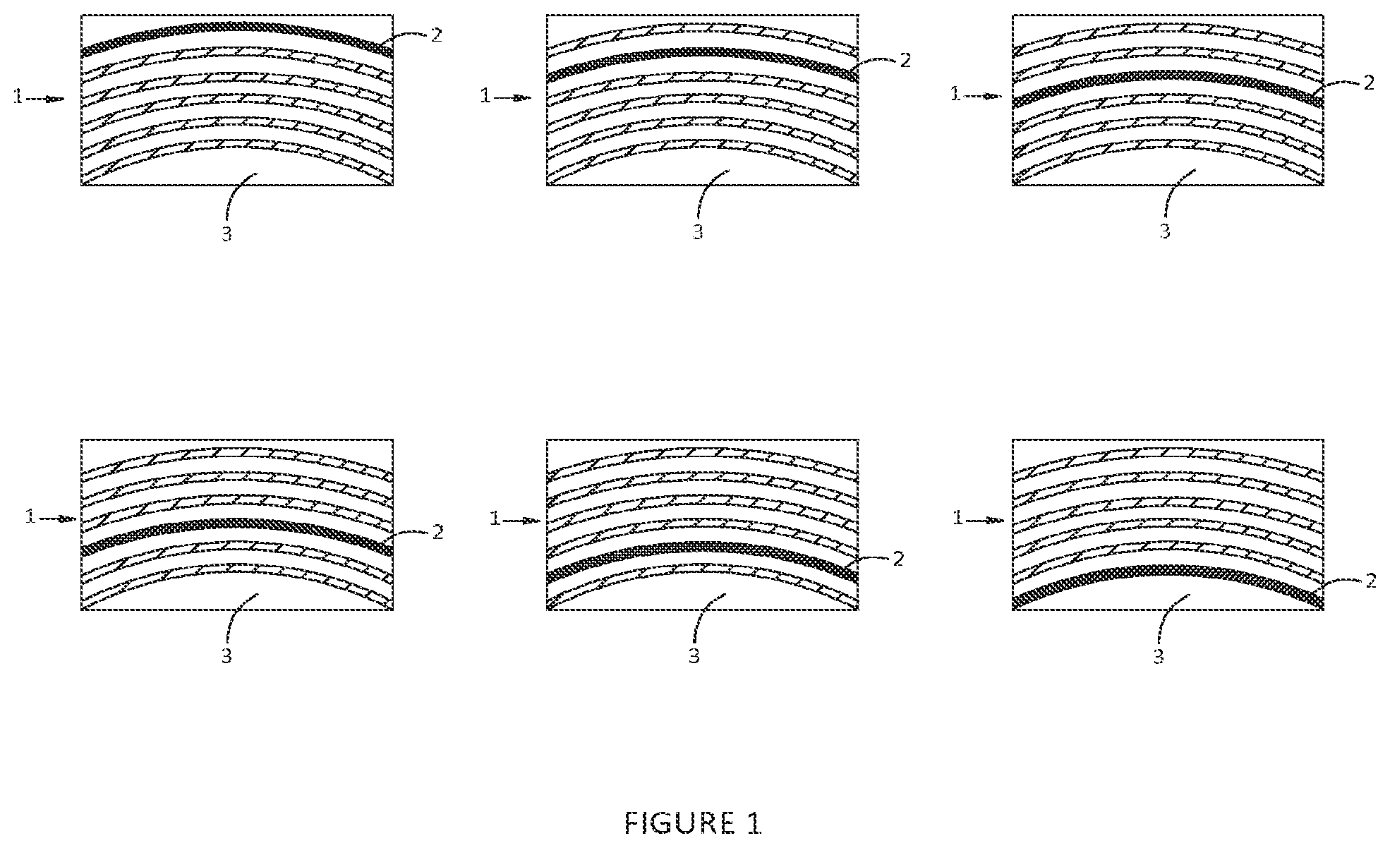 Patent US12569331 — Implant with a visual indicator of a barrier layer — Figure 1