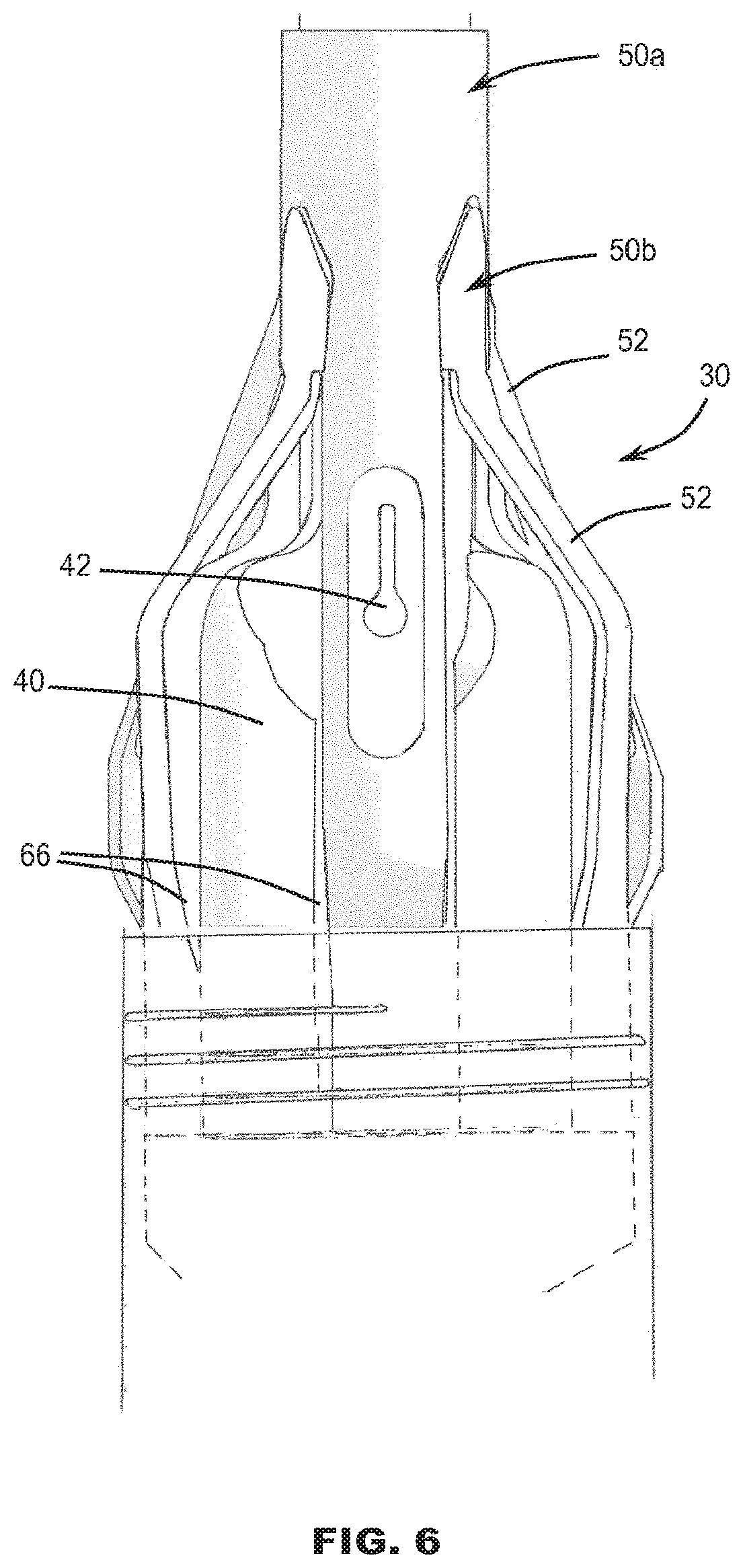 Patent US12569337 Figure 5 – Prosthetic valve, delivery apparatus and delivery method