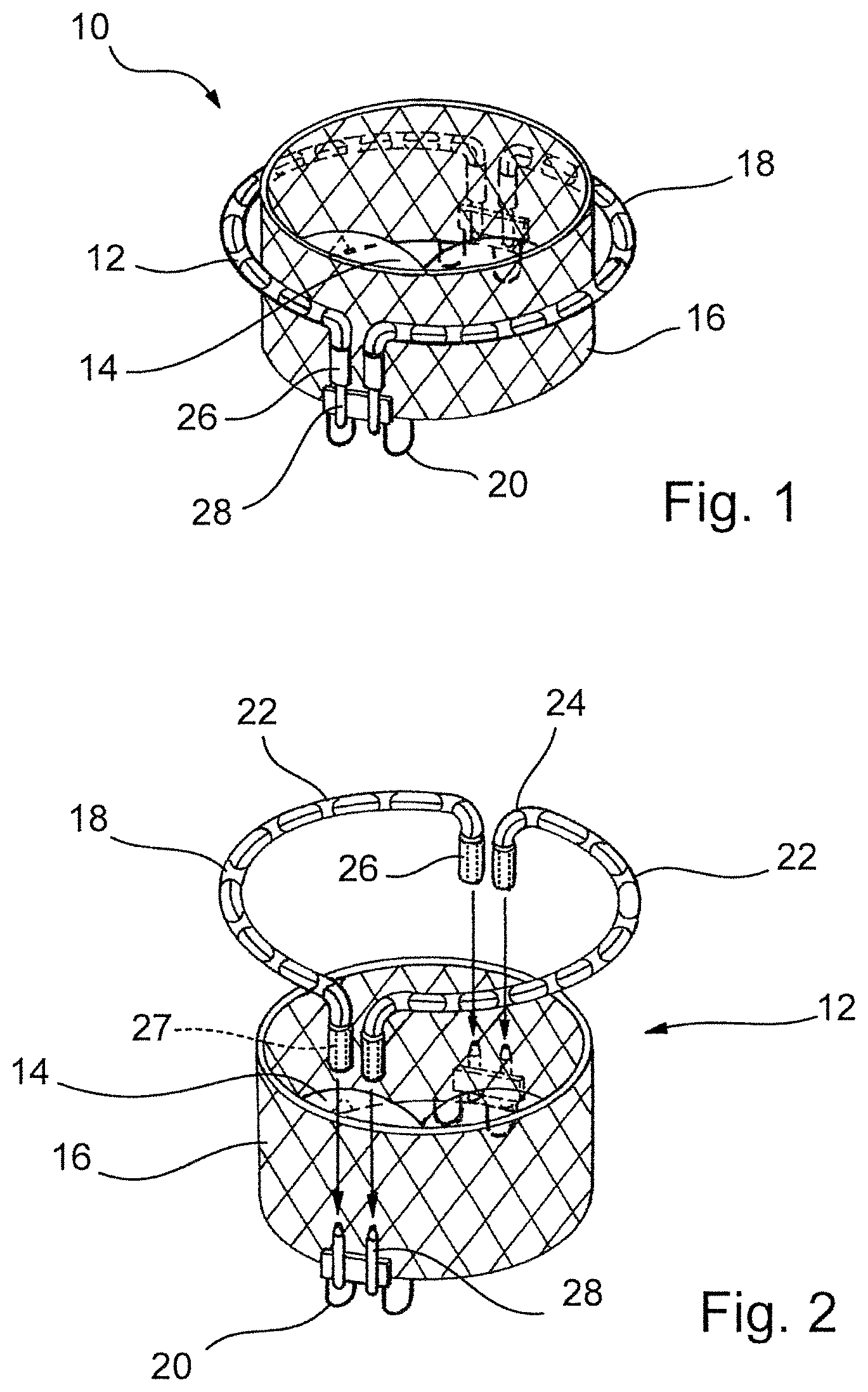 Patent US12569341 Figure 1 – Device for arranging guidewires around a heart valve