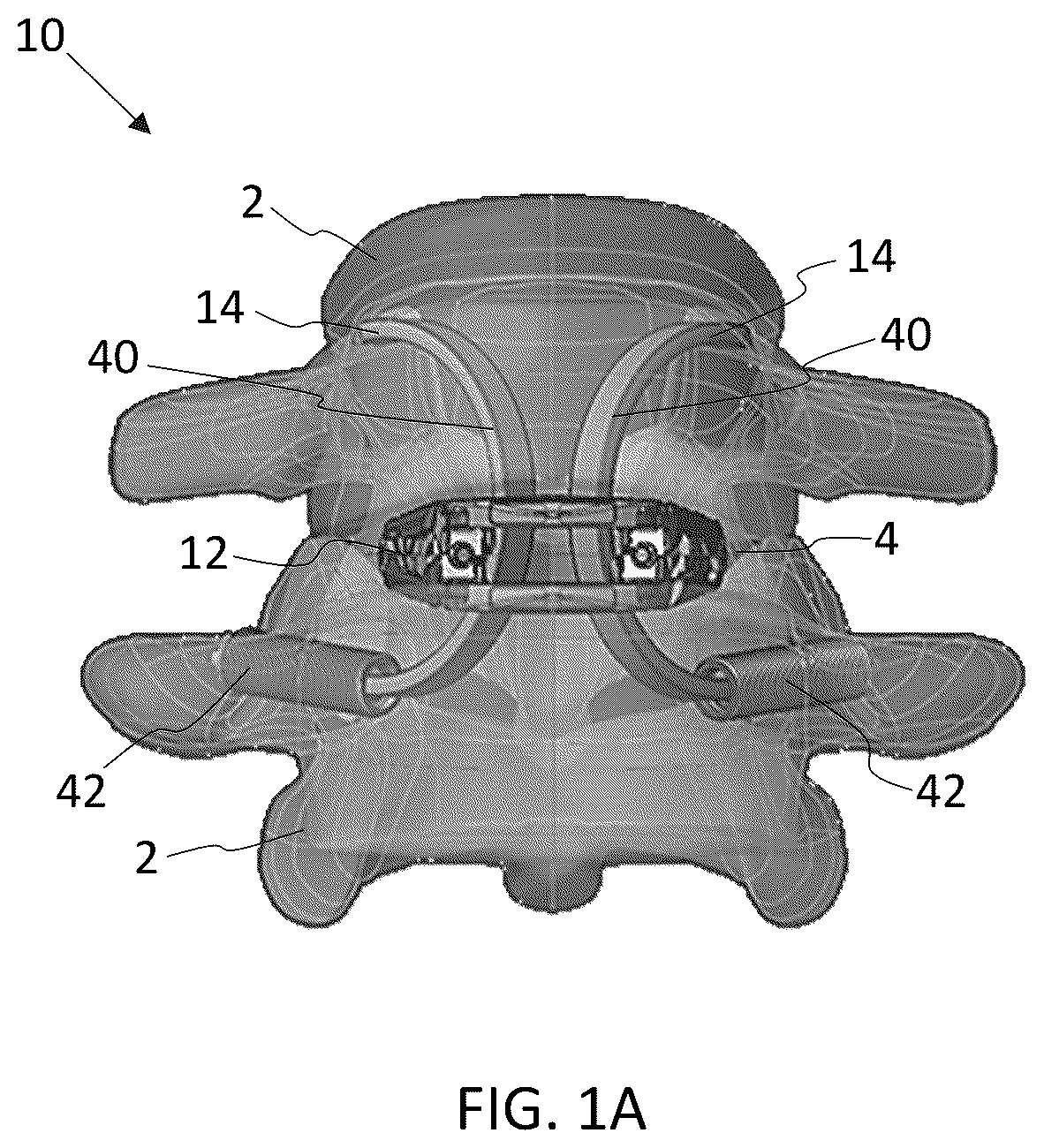 Patent US12569350 — Interlaminar lumbar interbody fusion implants, intradiscal implants, instruments, and methods — Figure 1