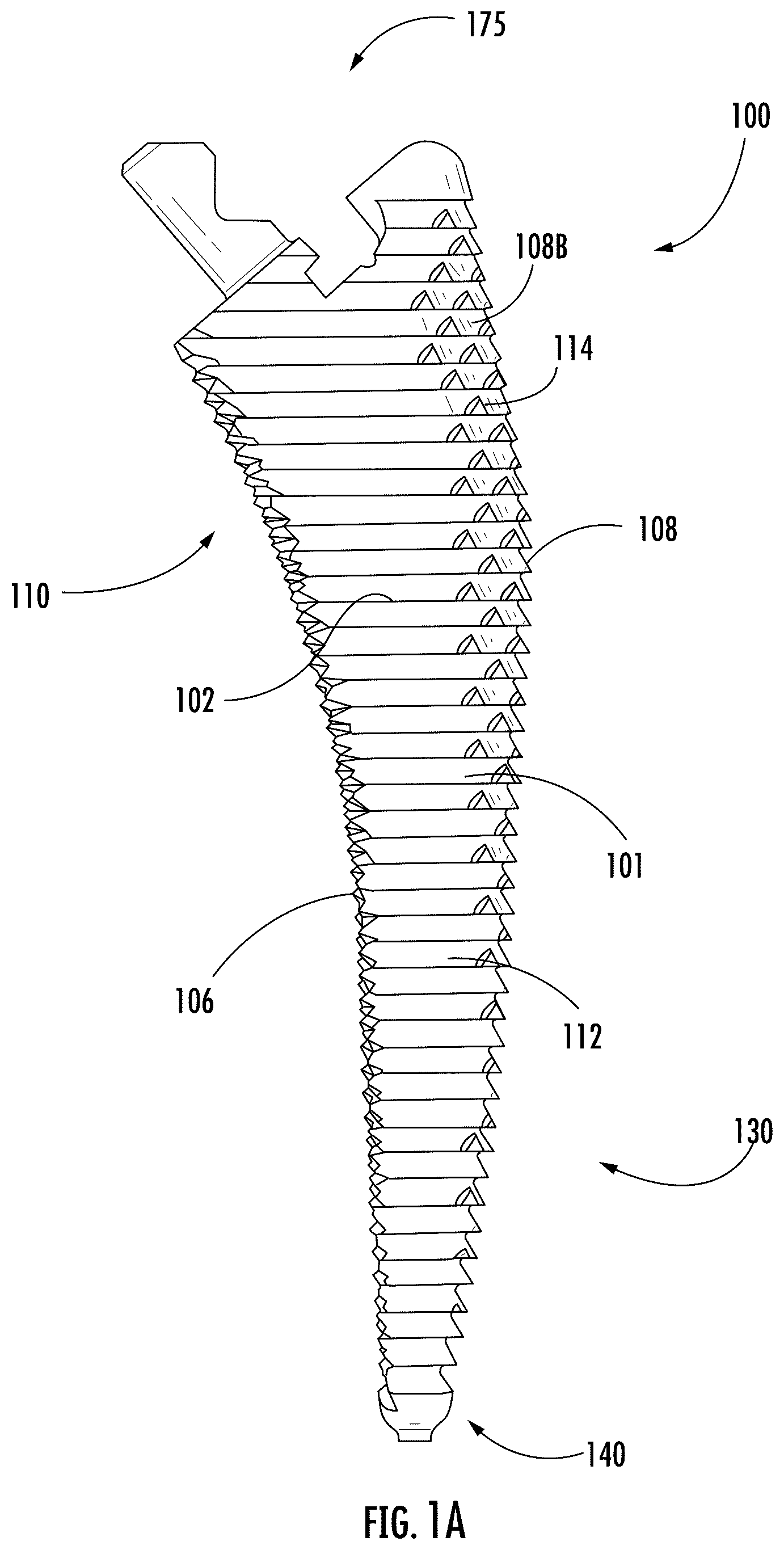 Patent US12569354 — Orthopedic broach — Figure 1