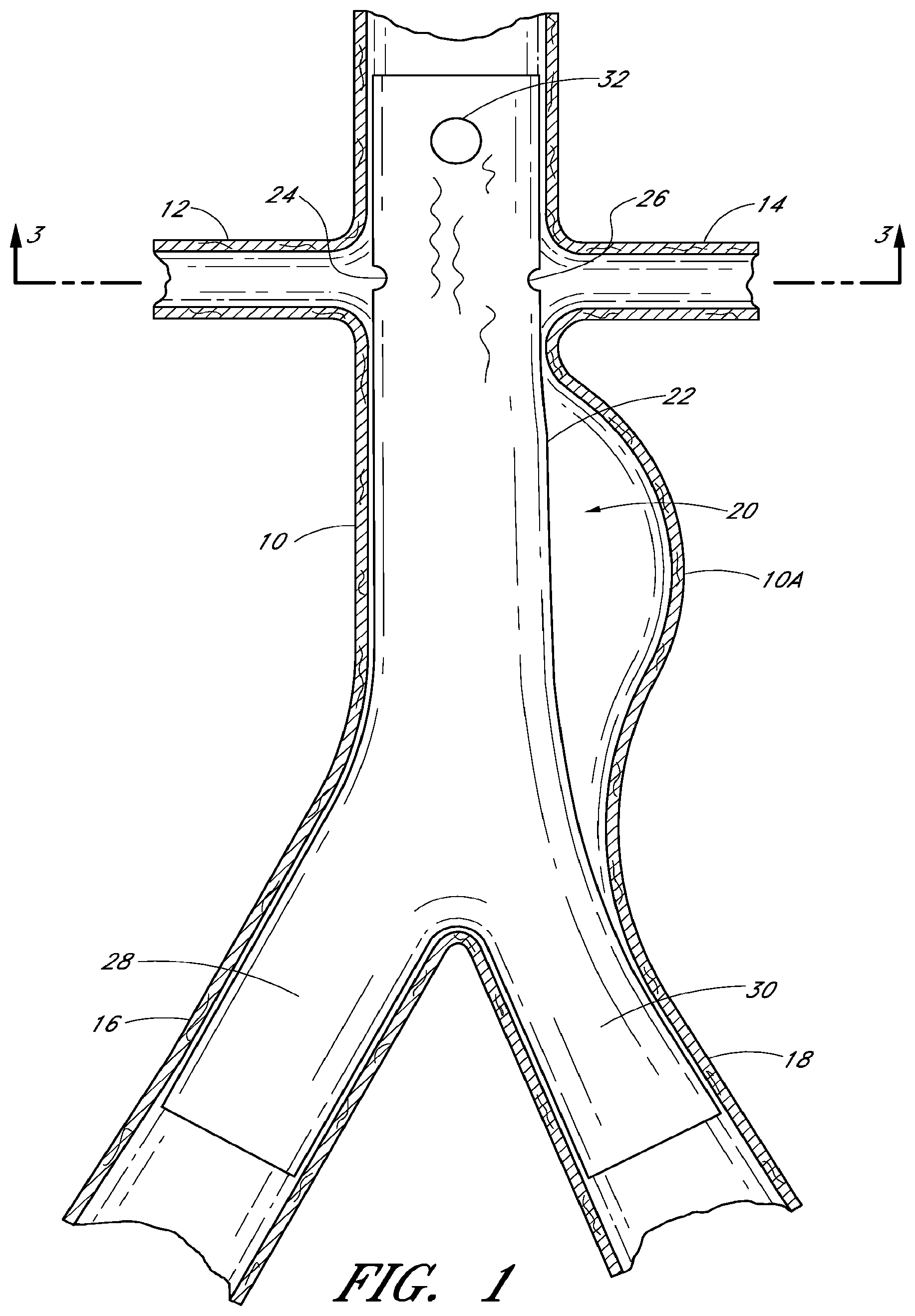 Patent US12569360 — Apparatus and method of placement of a graft or graft system — Figure 1