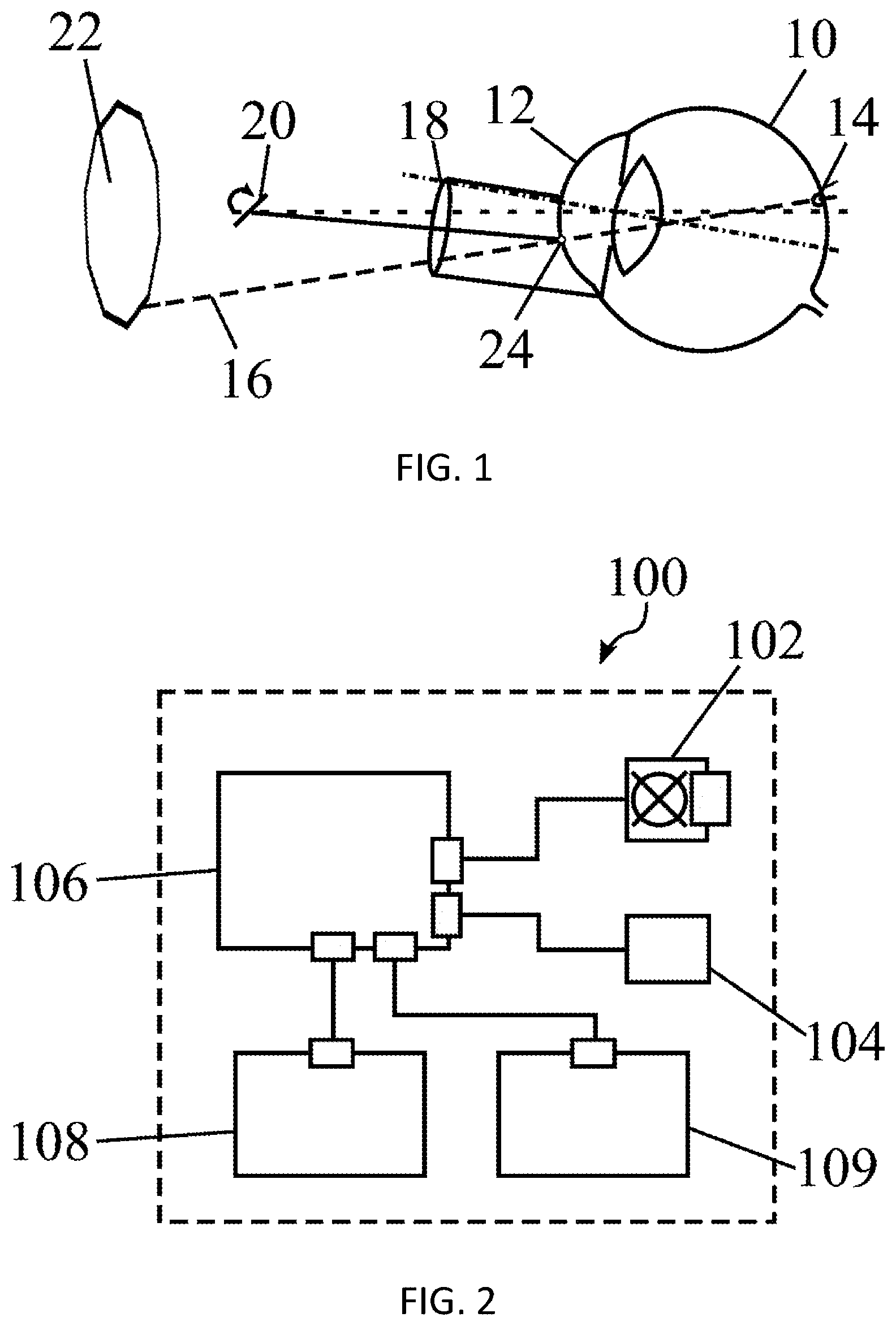 Patent US12569369 — System for laser-based ametropia correction, and method for the alignment thereof — Figure 1