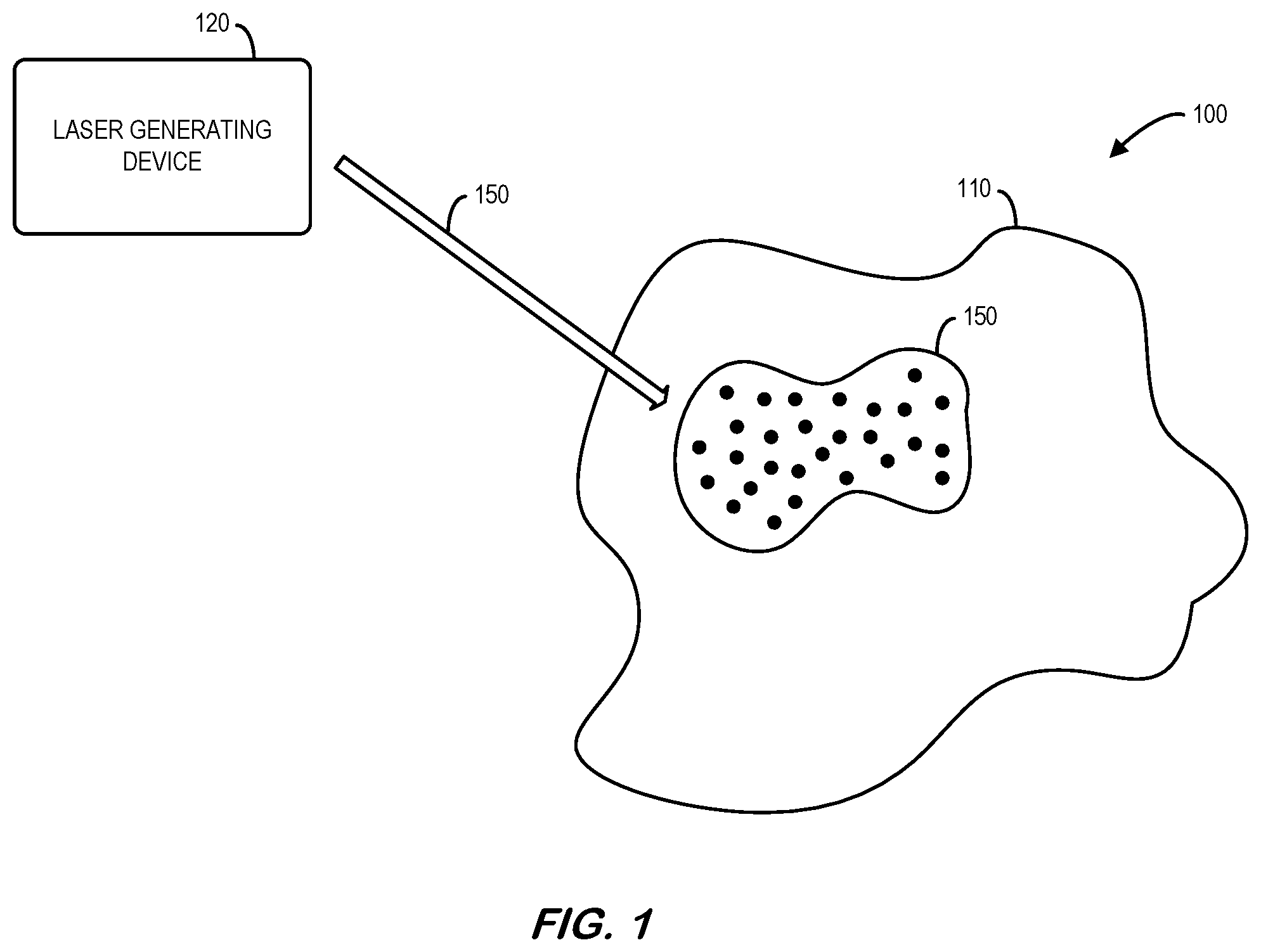 Patent US12569397 — Systems and methods for laser treatment of a dermatologic condition — Figure 1